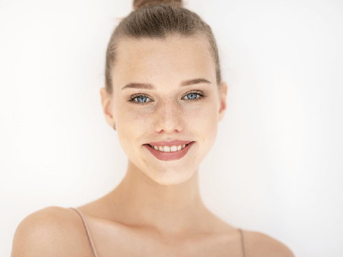 acne scars laser treatment North Andover MA 01845