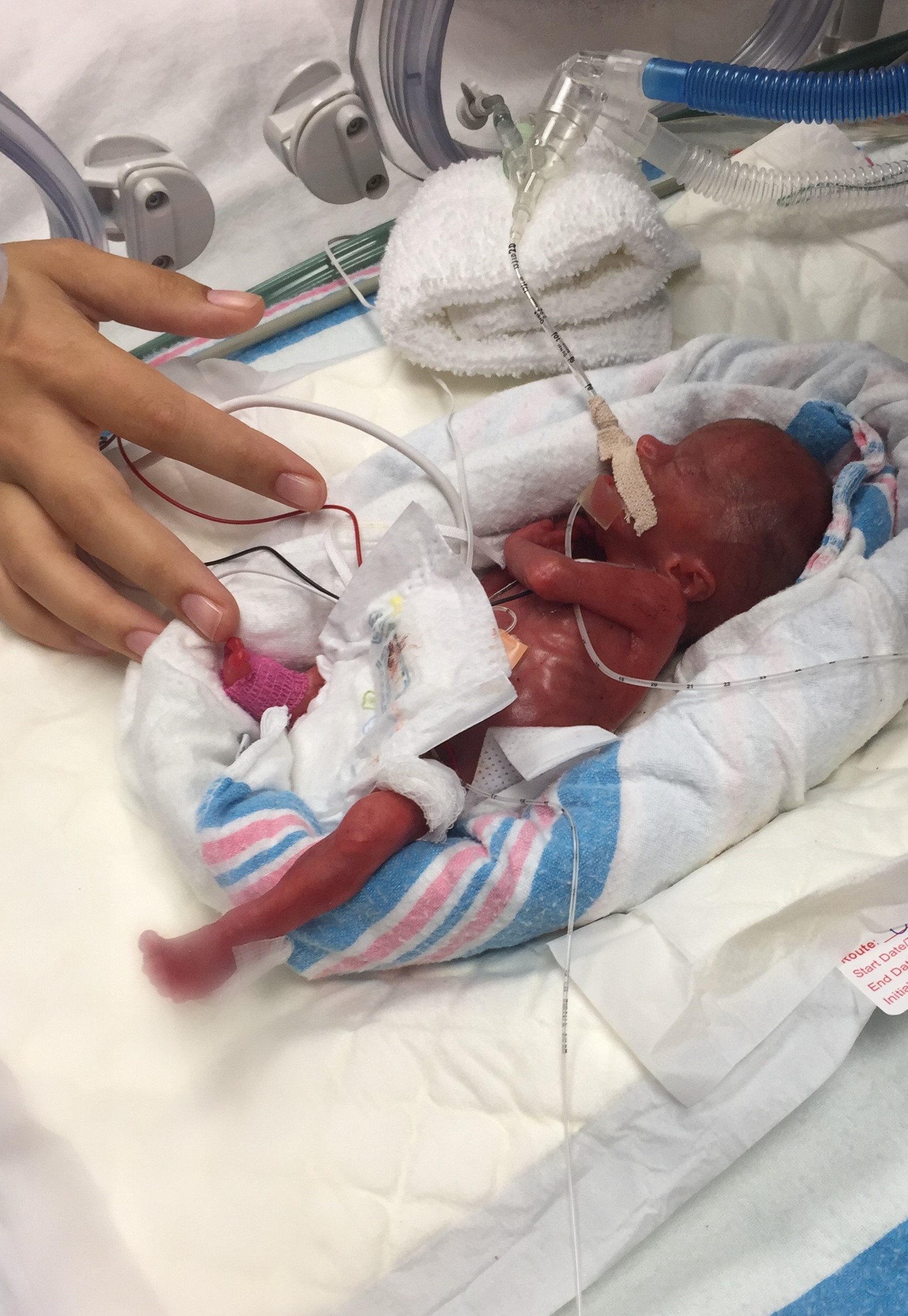 Josie after being delivered Josie