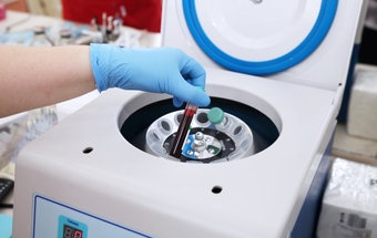 A patient's blood is spun in a centrifuge to separate plasma. centrifuge