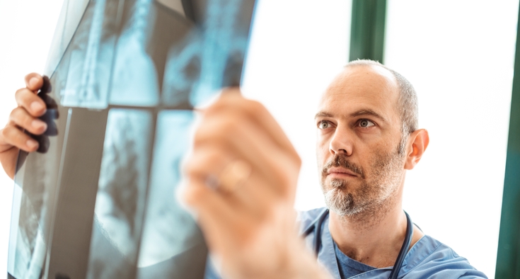 2_lung cancer screening
