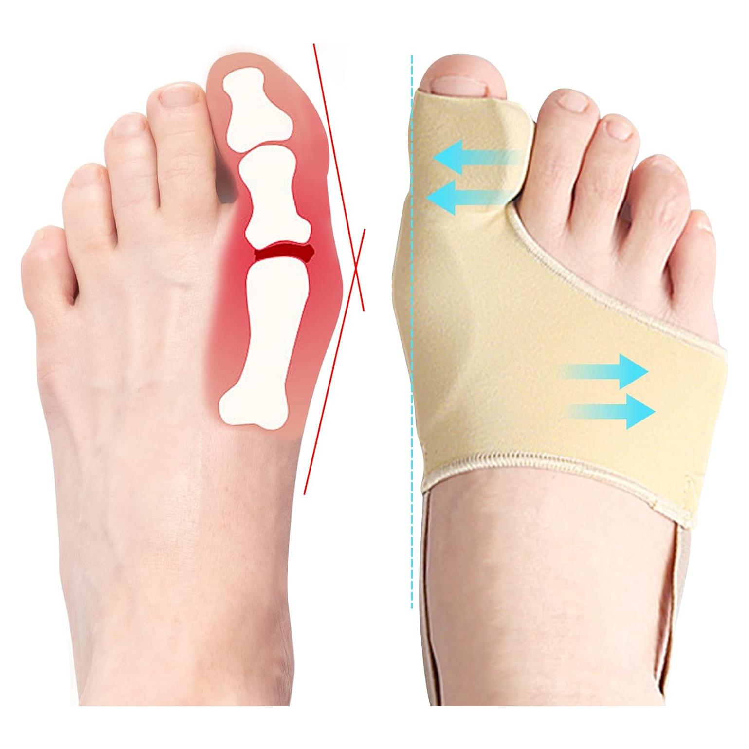 Corrector de Juanetes DFQ 2 Pcs para Alivio y Soporte M