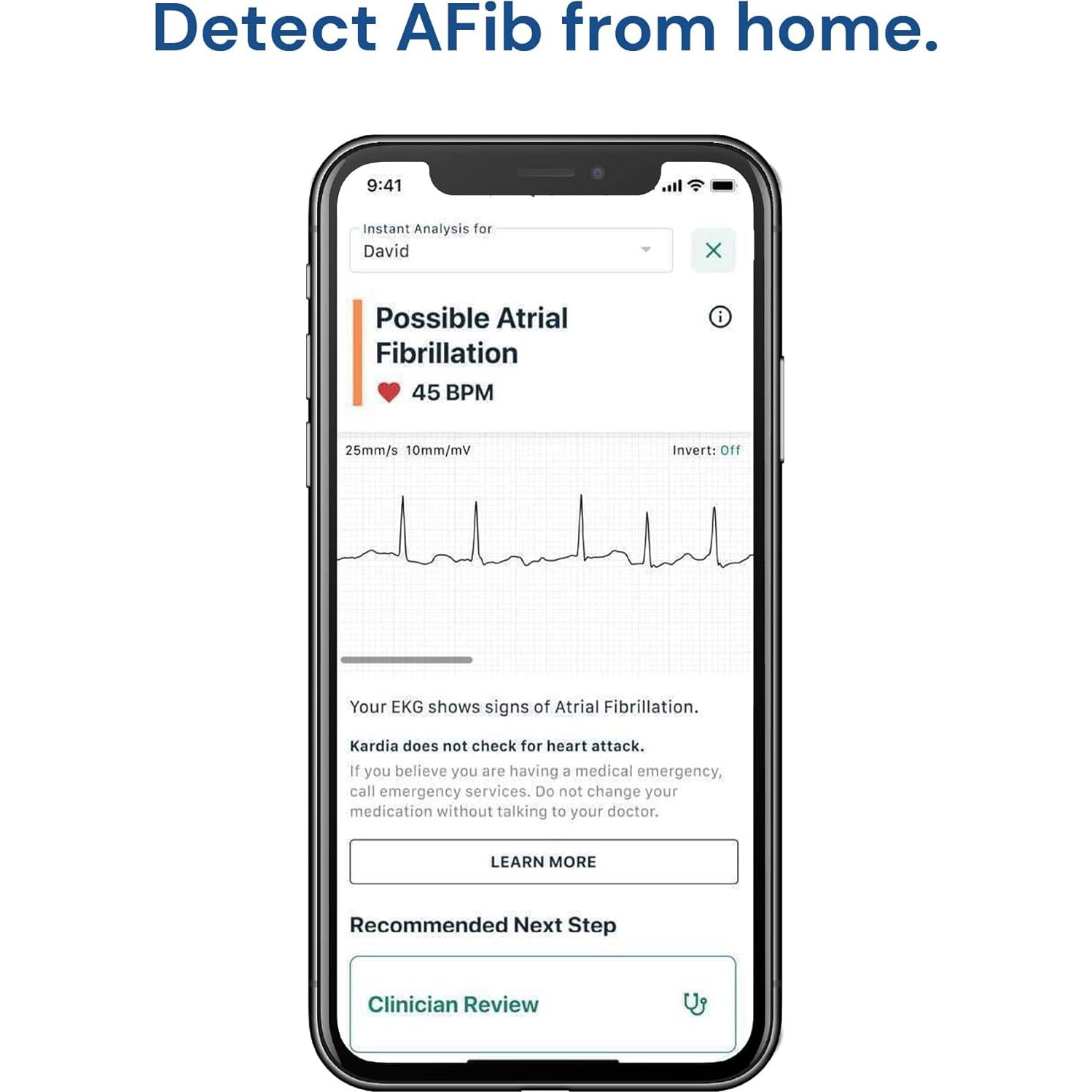 KardiaMobile Monitor EKG AliveCor 1 Derivación Gris