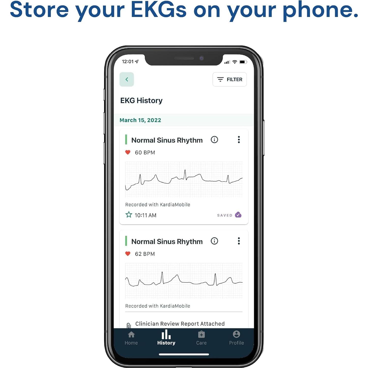 KardiaMobile Monitor EKG AliveCor 1 Derivación Gris
