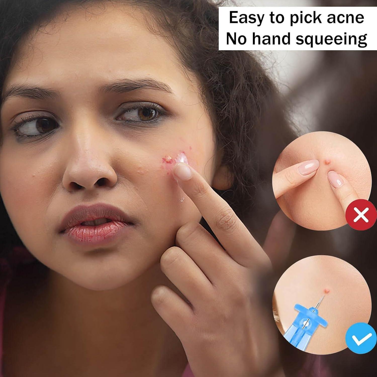 Set de 65 Herramientas Desechables Ybaoo para Remoción de Acné