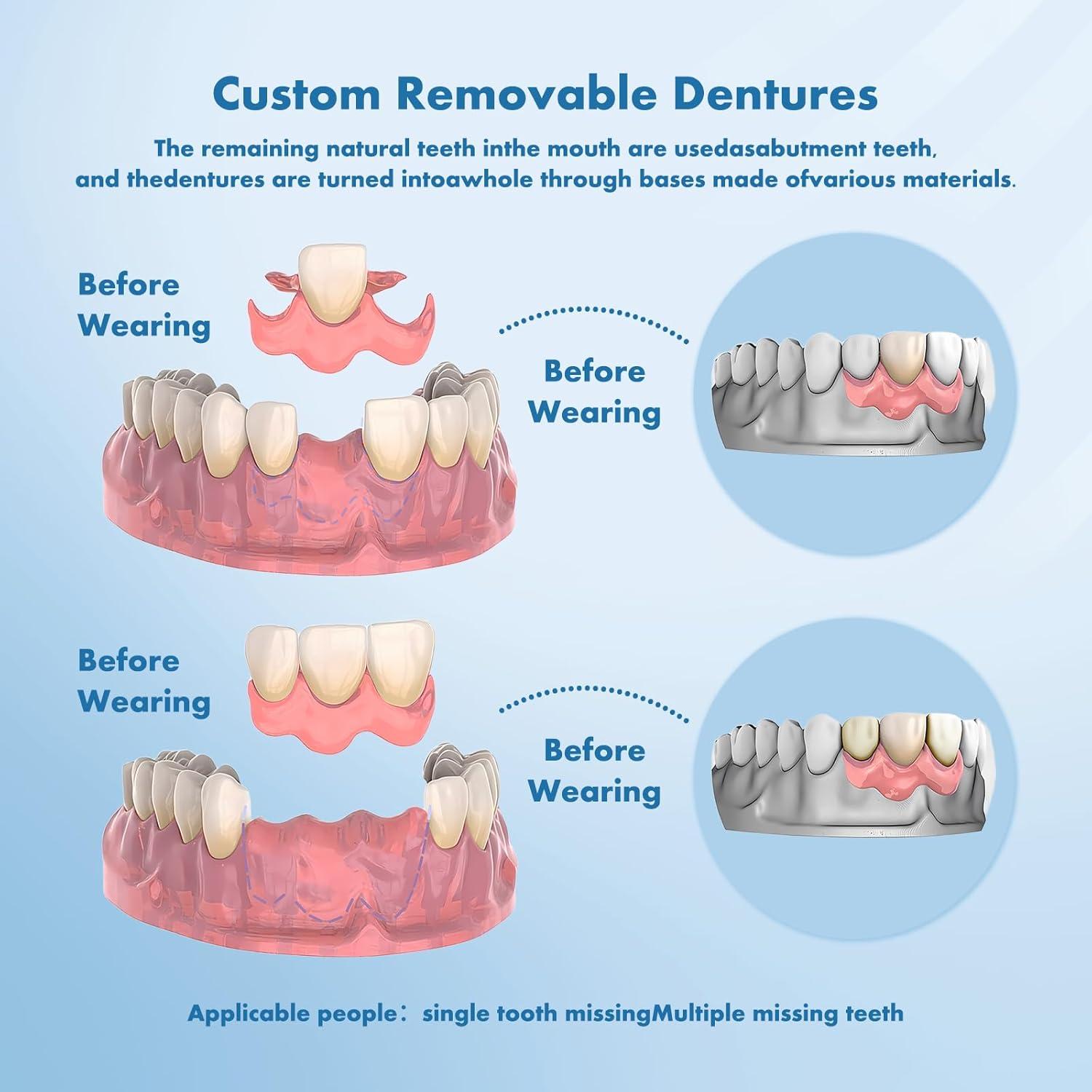 Dentaduras Removibles Personalizadas Qiivosm - 2 Dientes