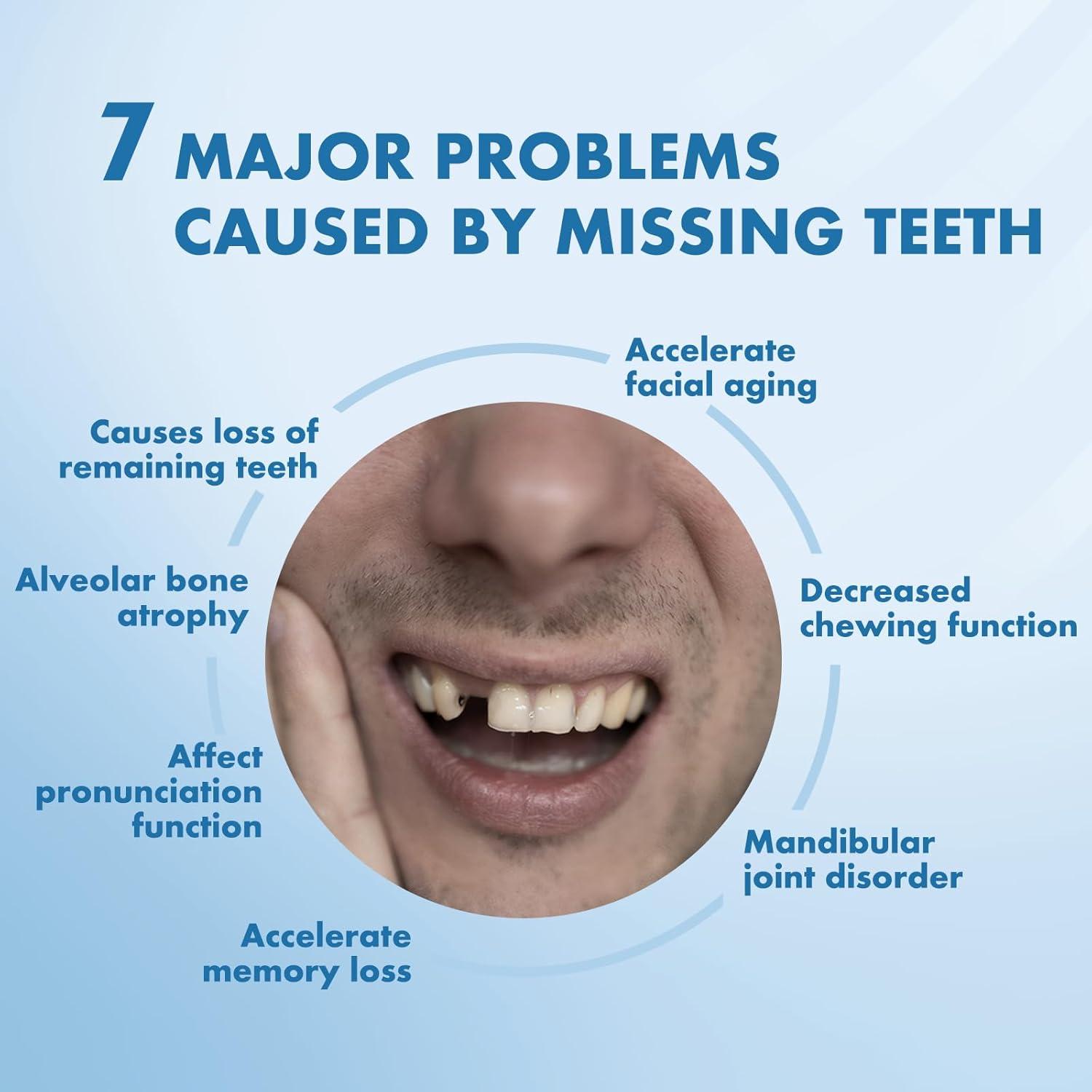 Dentaduras Removibles Personalizadas Qiivosm - 2 Dientes