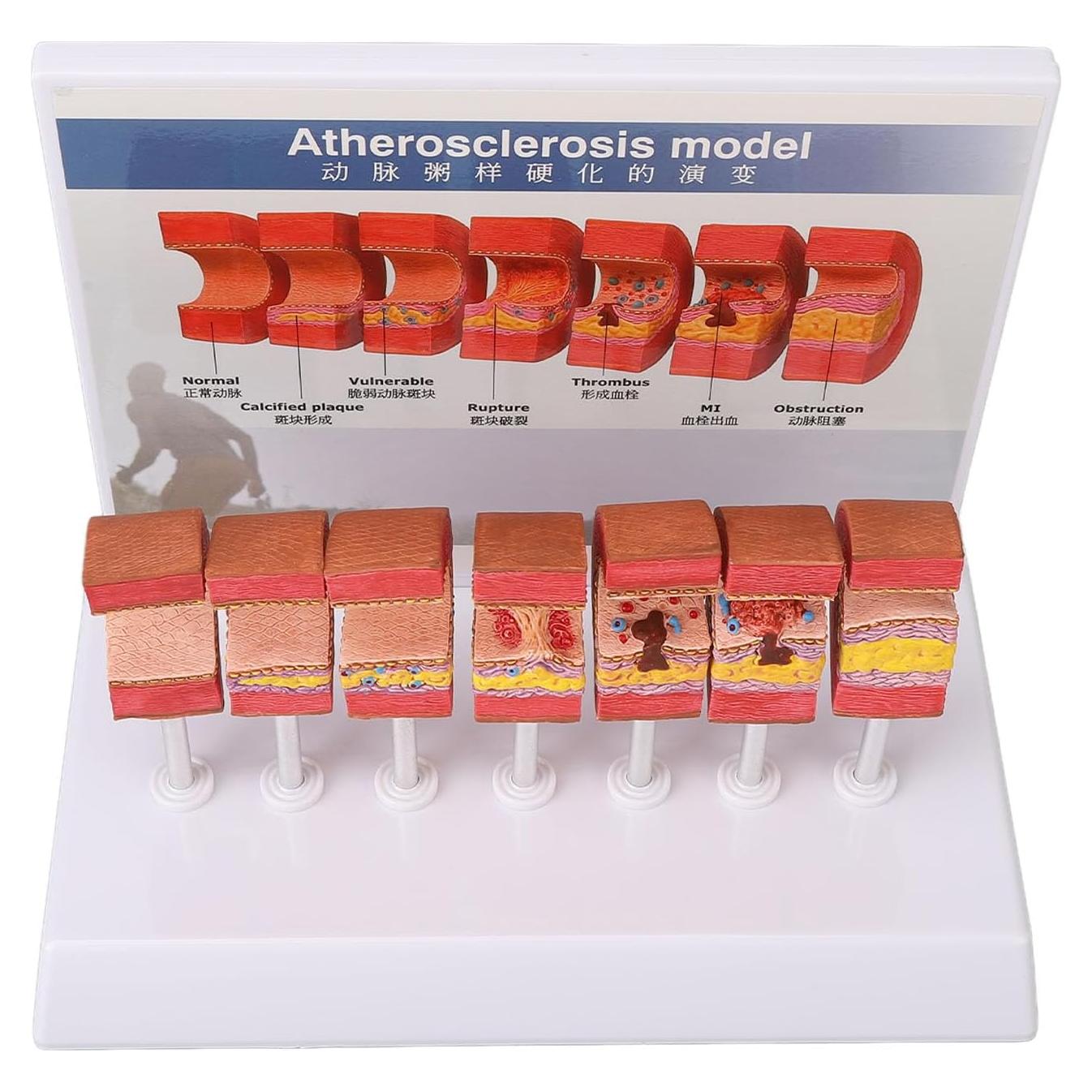 Modelo de Anatomía Arterial 7 Piezas LUCKDANO PVC Educativo