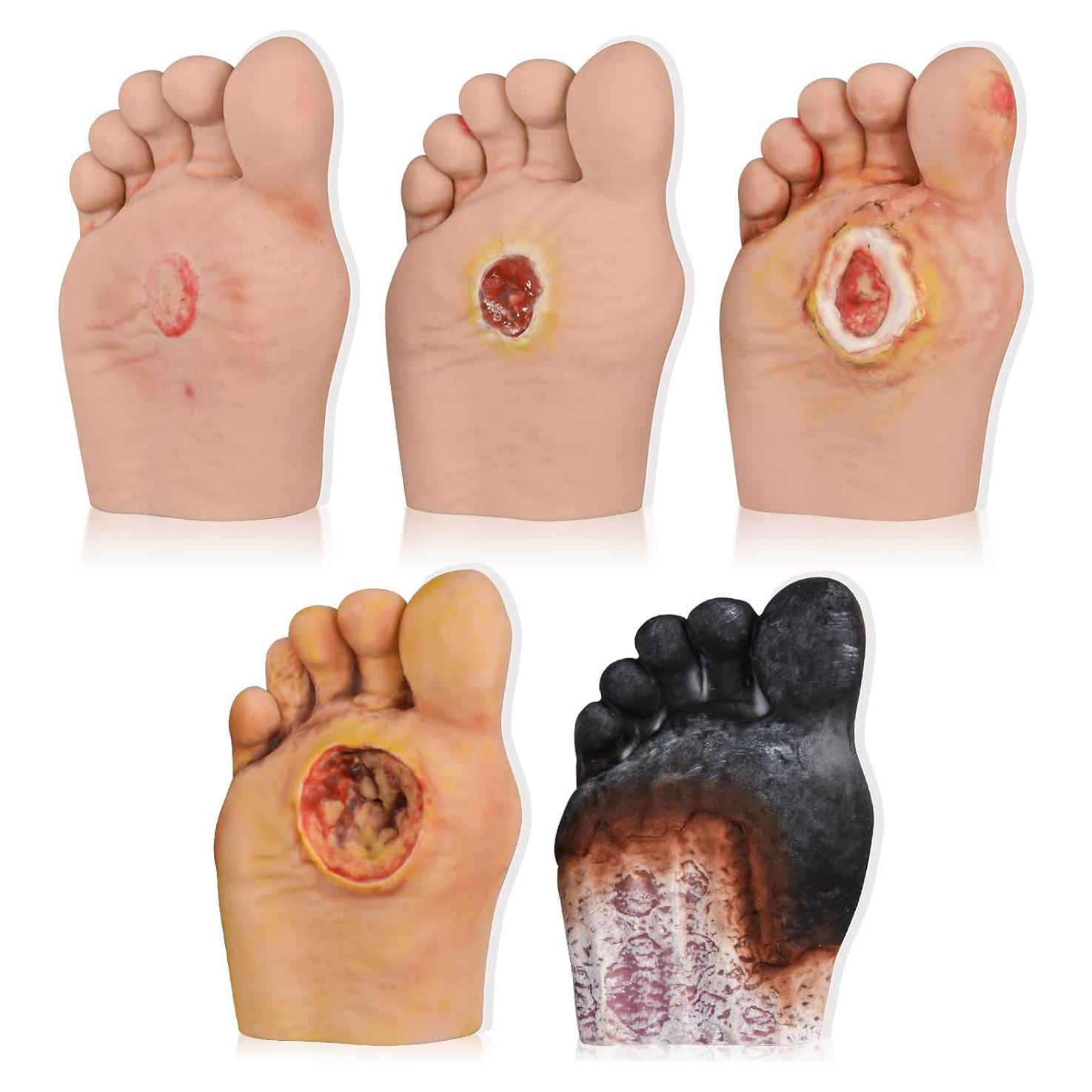 Modelo de Cuidado del Pie Diabético 5 Pcs Ultrassist