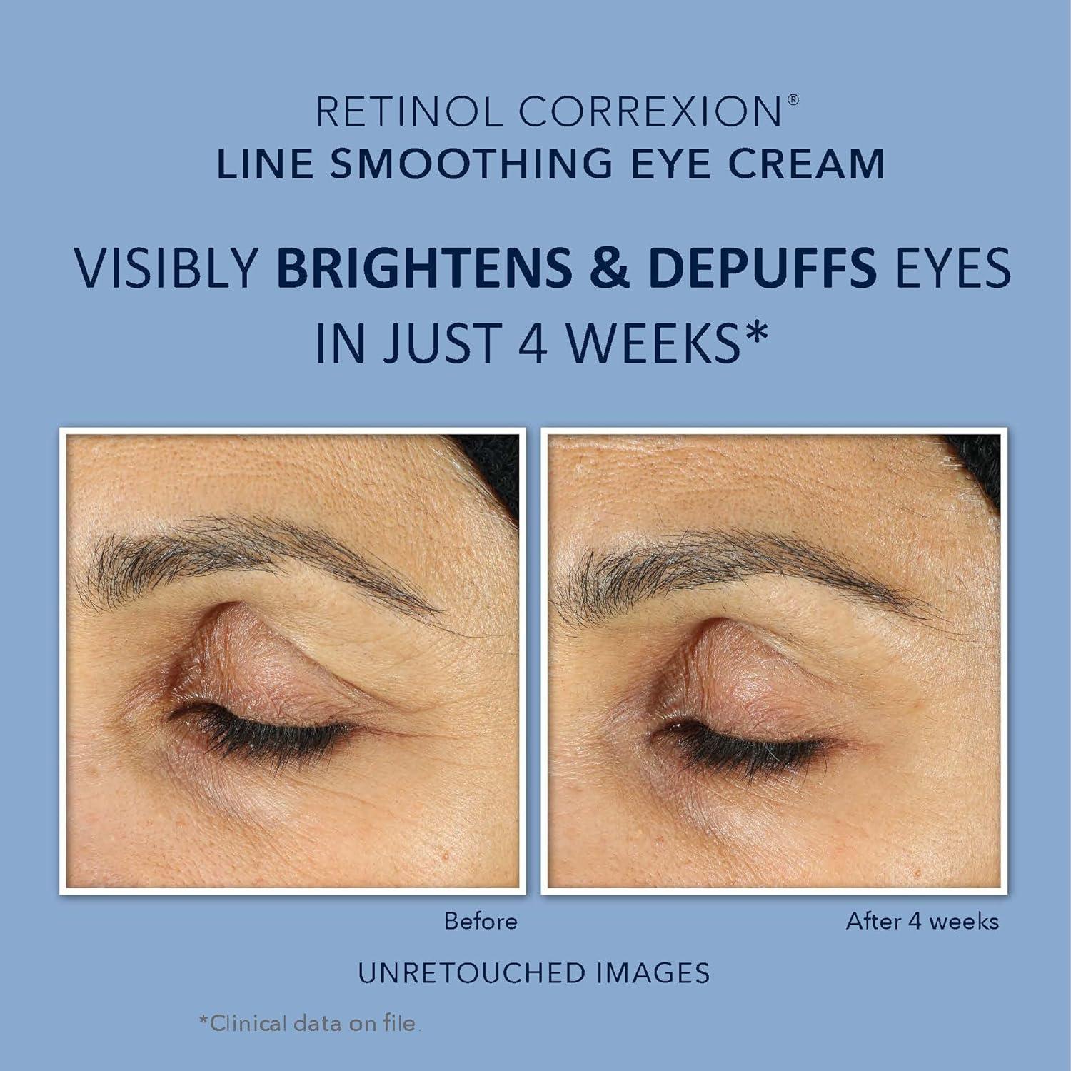 Conjunto RoC Retinol Correxion Crema Facial y Ojos 91g