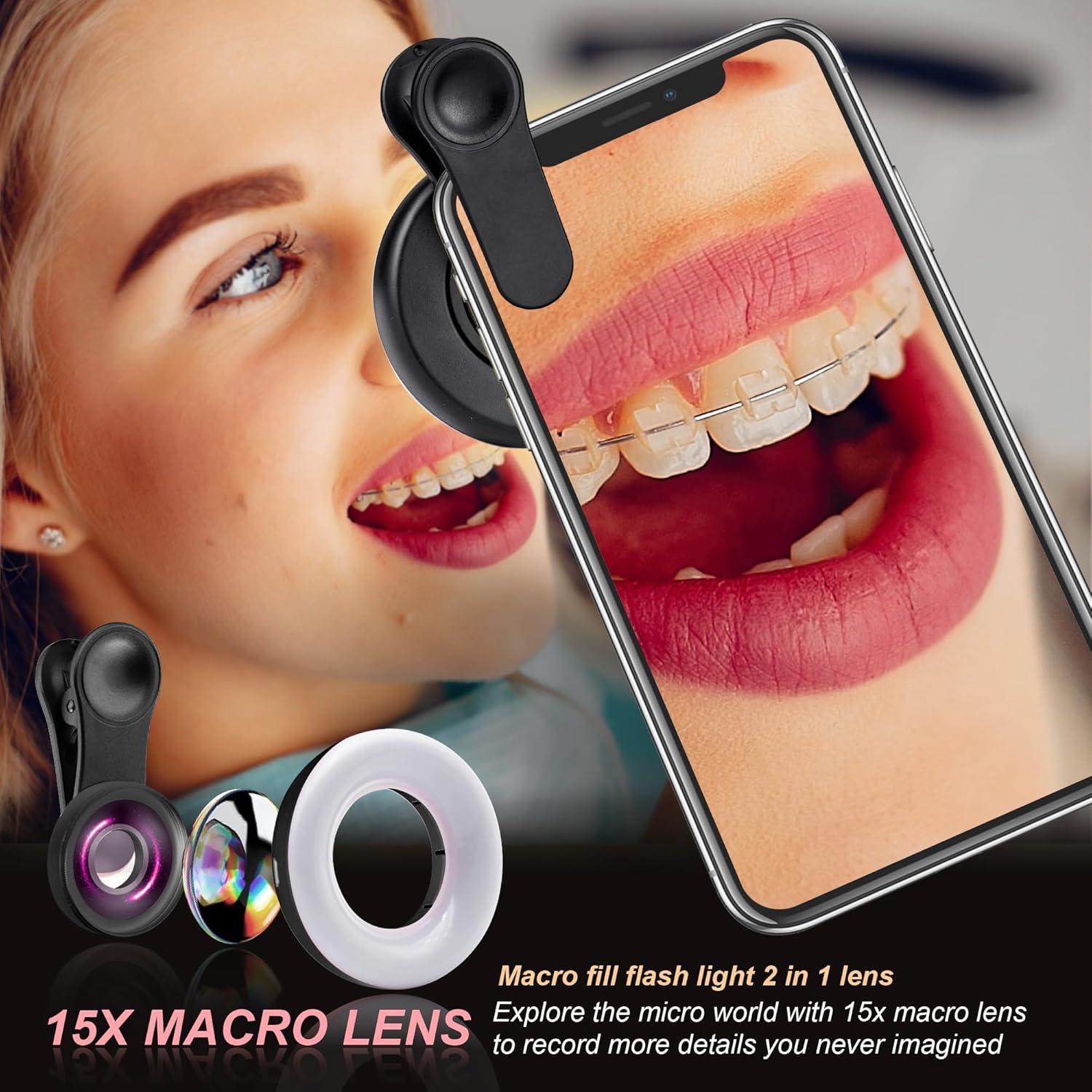 Lente Macro YZZY con Luz de Anillo para Smartphone - Negro