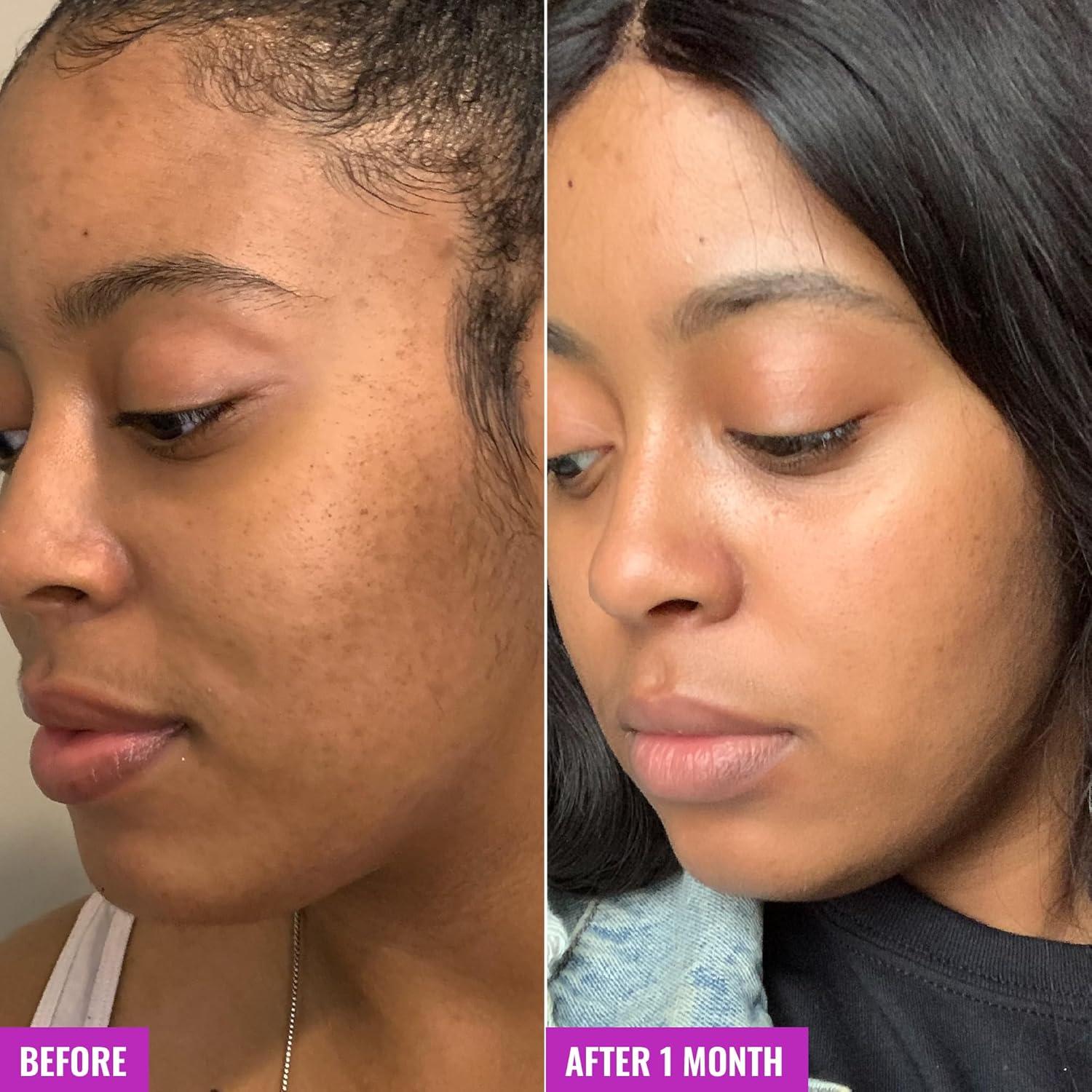 Tónico Exfoliante Good Molecules 120ml Ácido Glicólico Hidratante