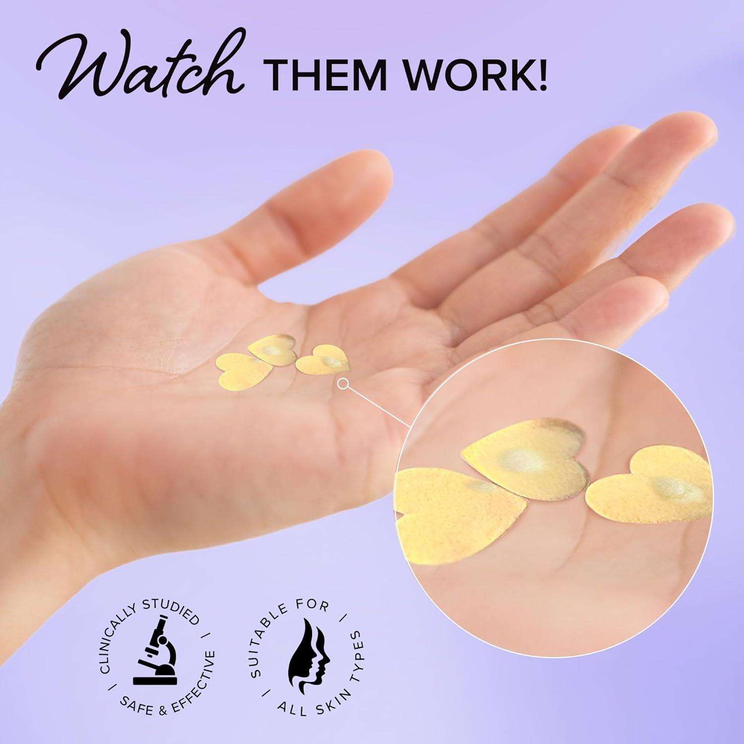 Parches para Acné MAREE Star - 72 Unidades Hidrocoloides