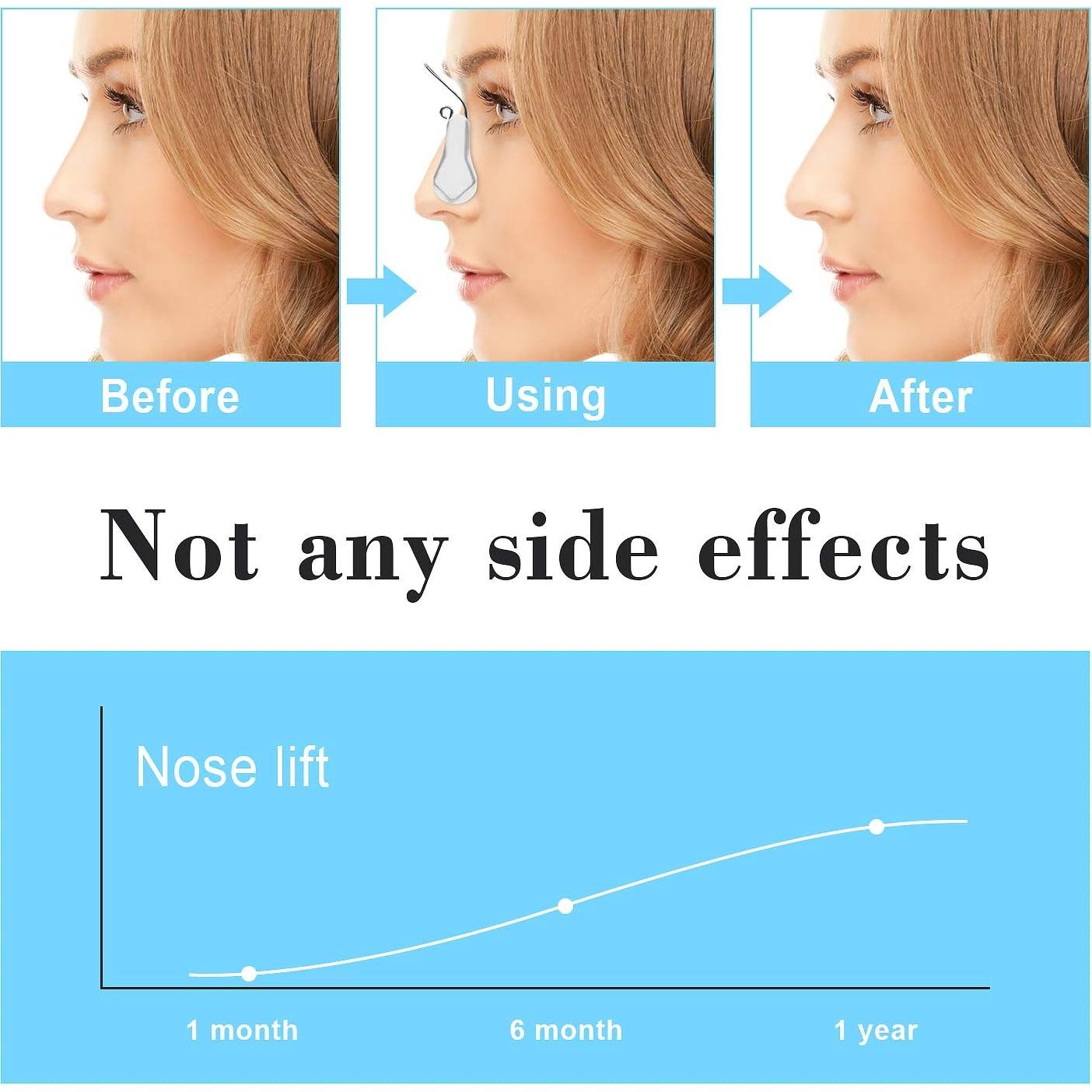 Clip Corrector de Nariz FERNIDA de Silicona - Elevador Nasal