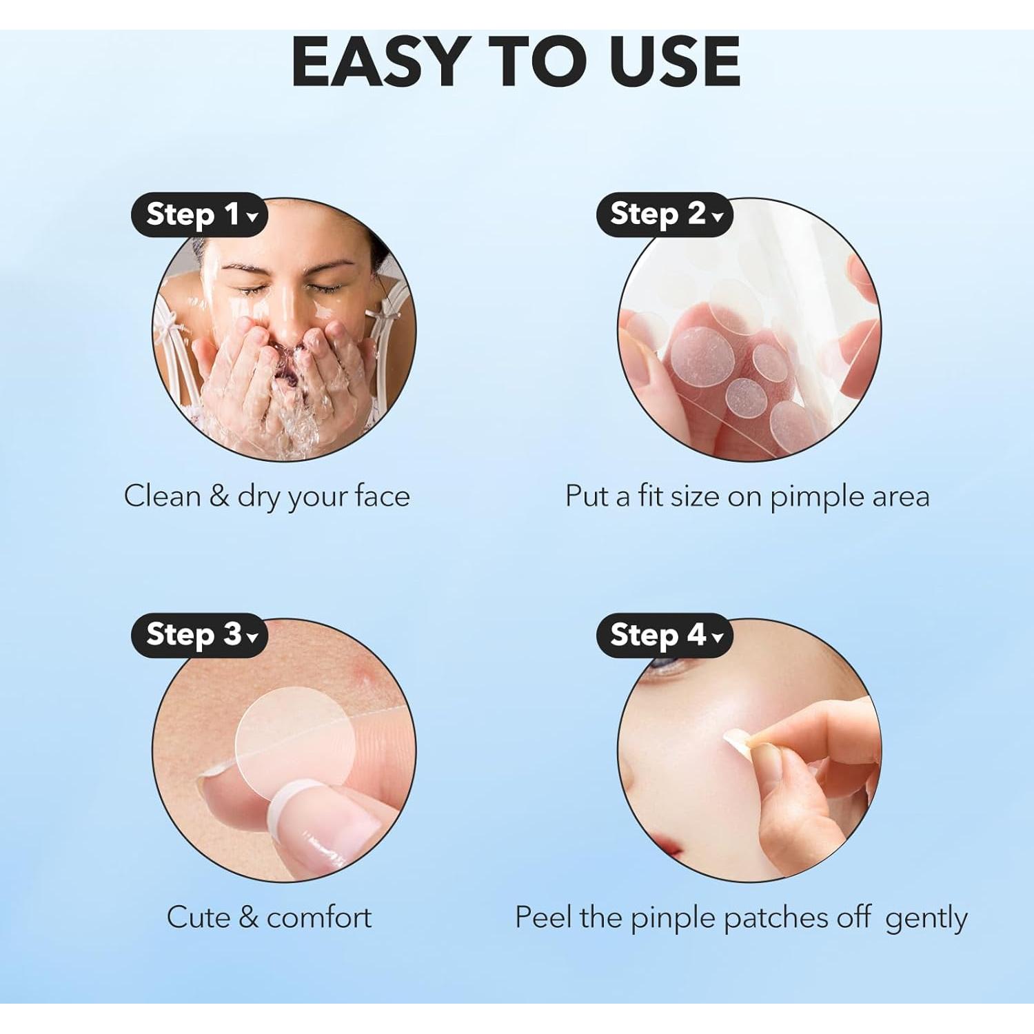 Parches para Granos QUSTERE Hidrocoloide 288 Unidades 9mm 12mm