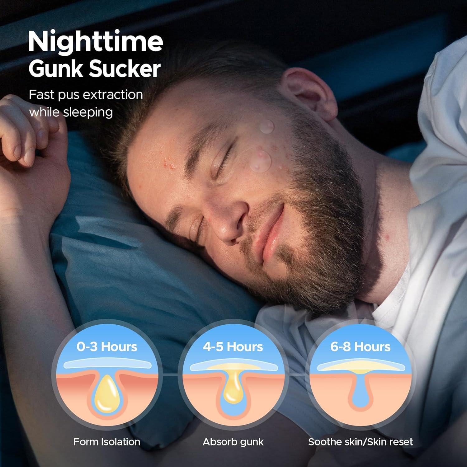 Parches para Acné LitBear - 400 Unidades, 5 Tamaños Hidrocoloide