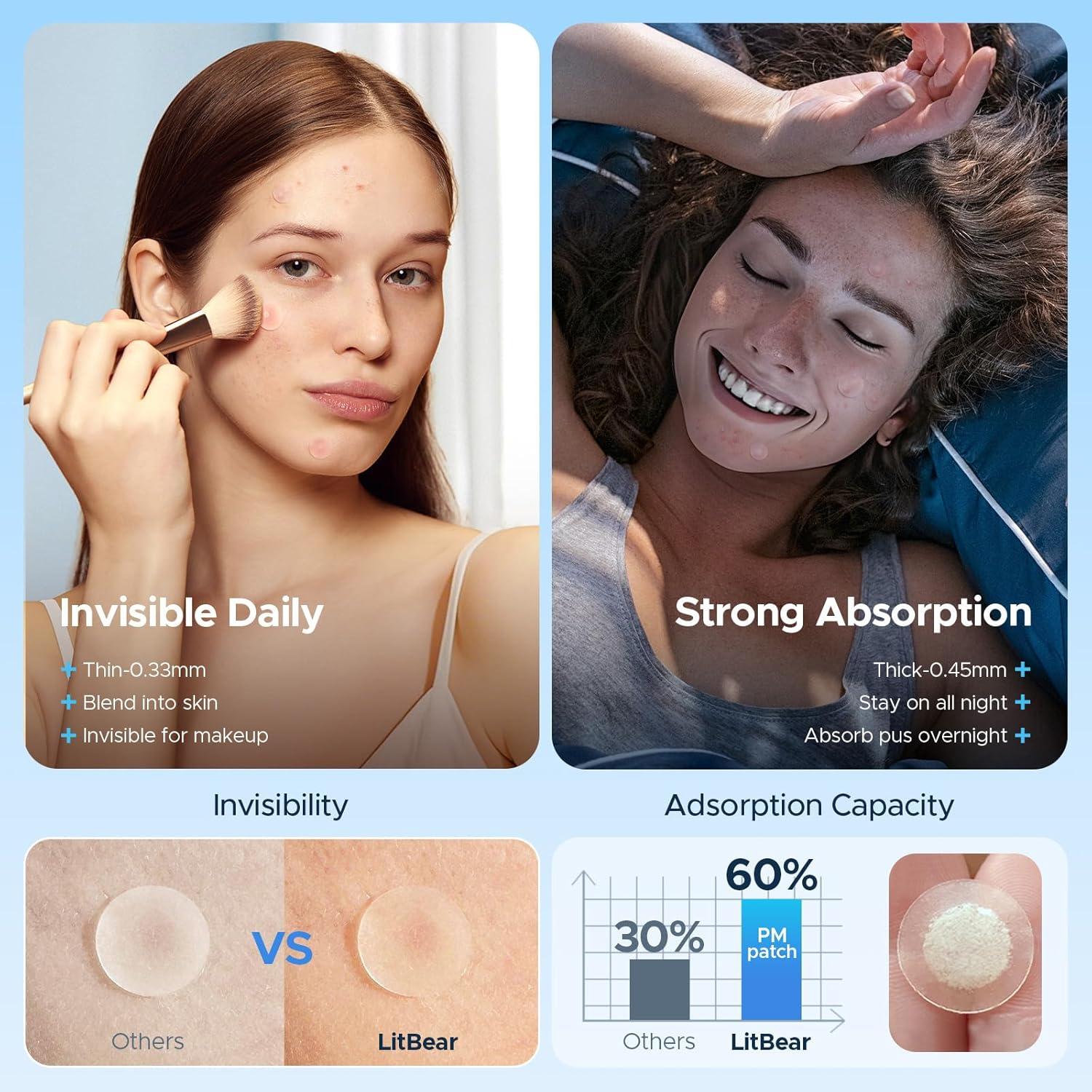 Parches para Acné LitBear - 400 Unidades, 5 Tamaños Hidrocoloide