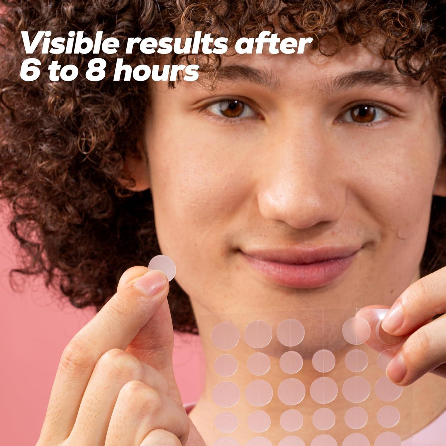 Parches Hidrocoloides para Imperfecciones Hanhoo - 288 Unidades