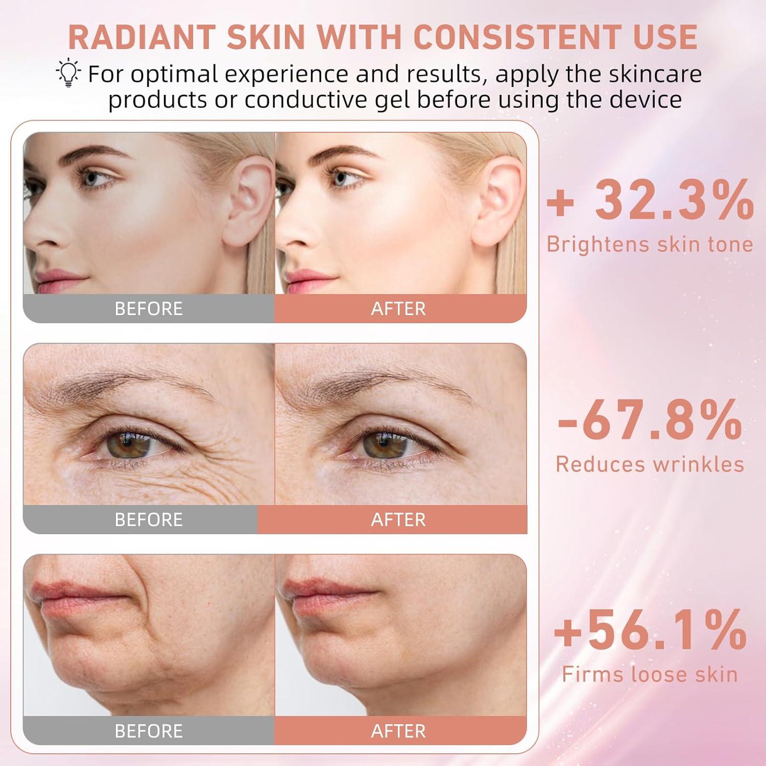 Dispositivo de Belleza Facial OUJEALEE AM-810B, Microcorriente y Luz LED