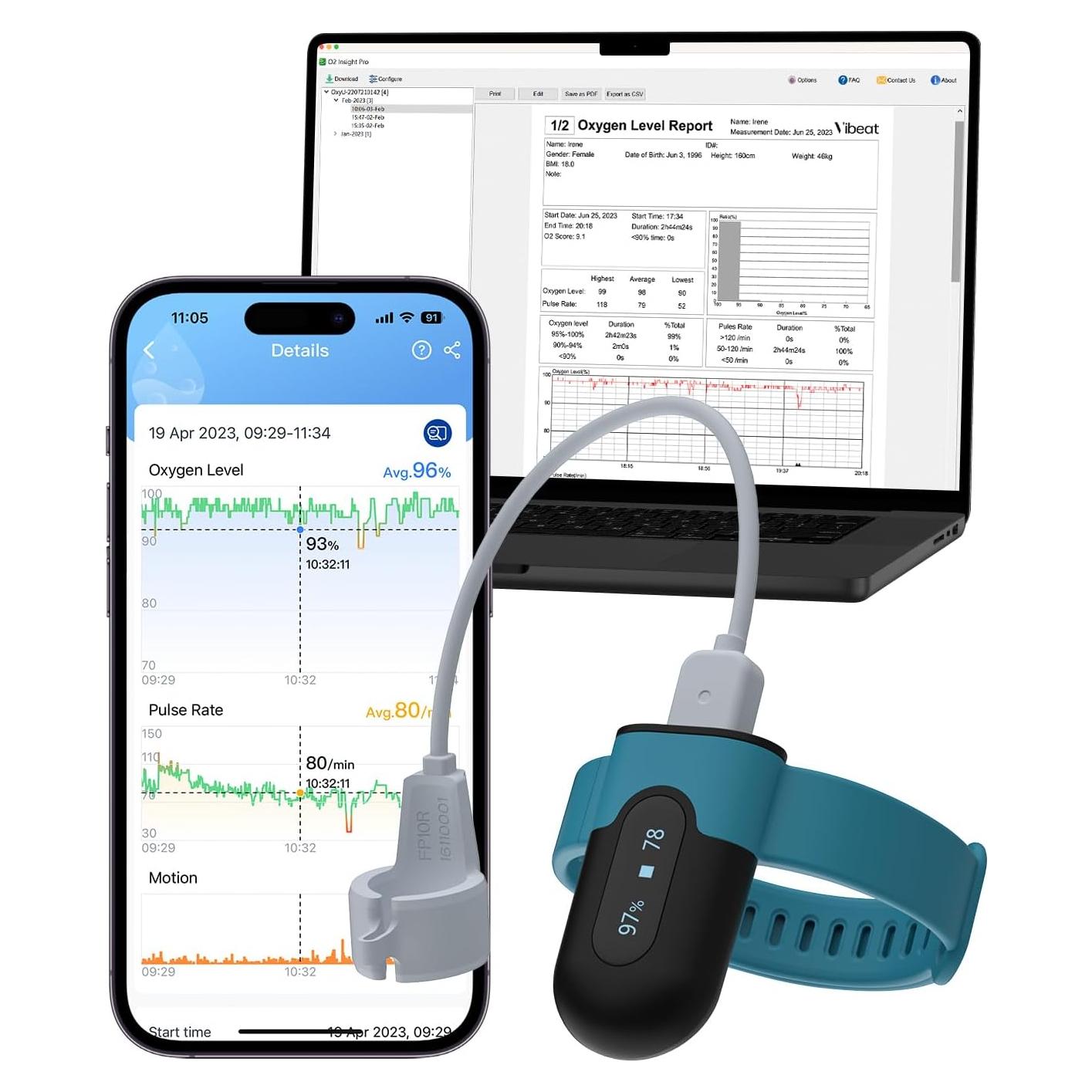 Oxímetro de Pulso Vibeat OxyU - Monitor de Oxígeno Bluetooth