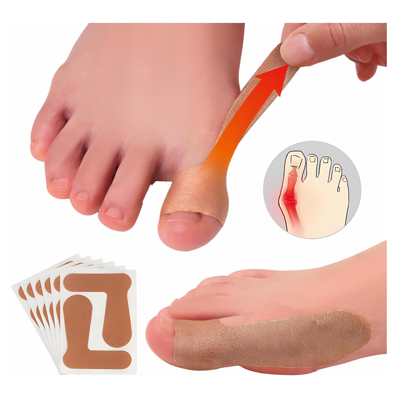 Corrector de Juanetes BLacOh 20 PCS Soporte Dedo Gordo