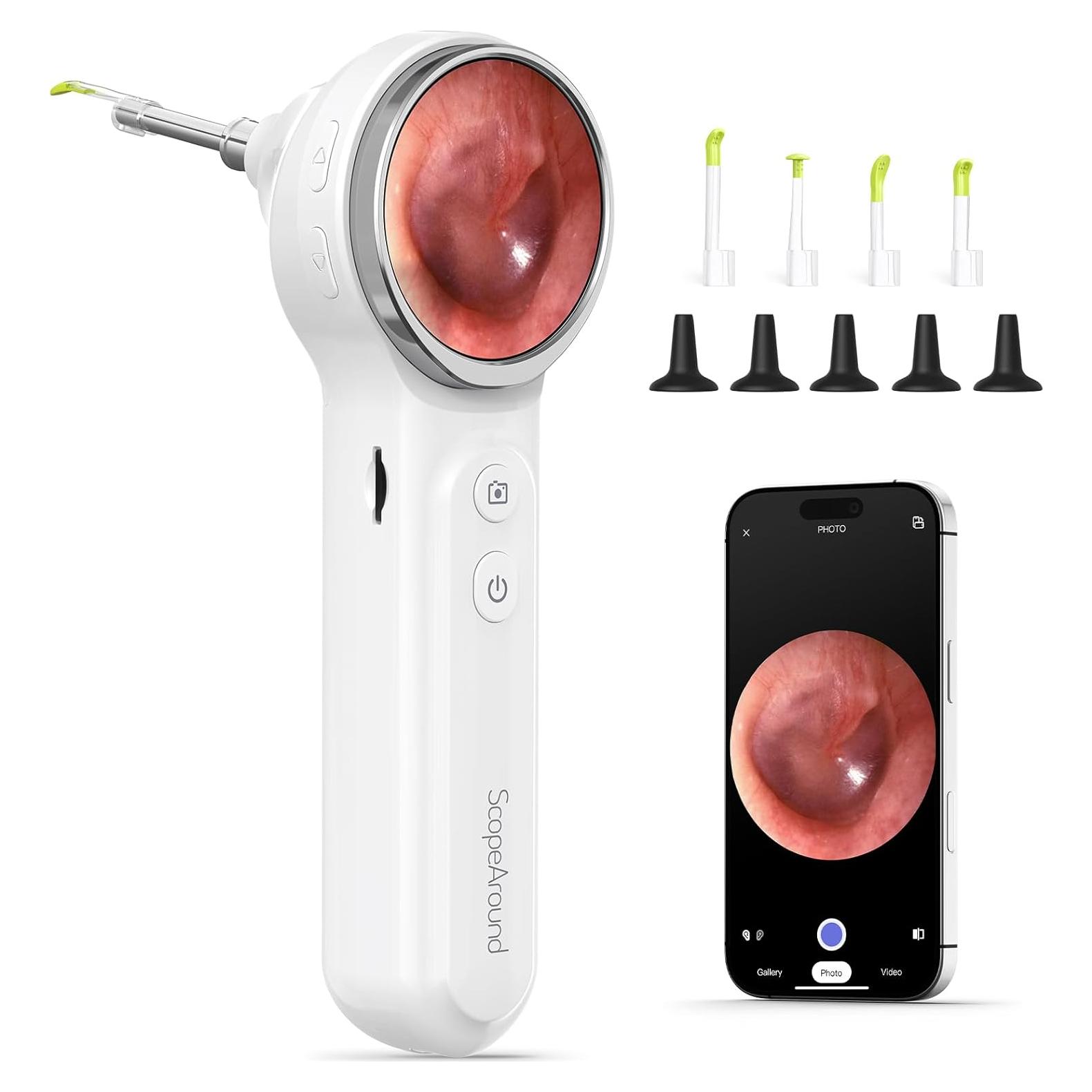 Otoscopio Digital ScopeAround con Pantalla IPS 4.7cm y Luz LED