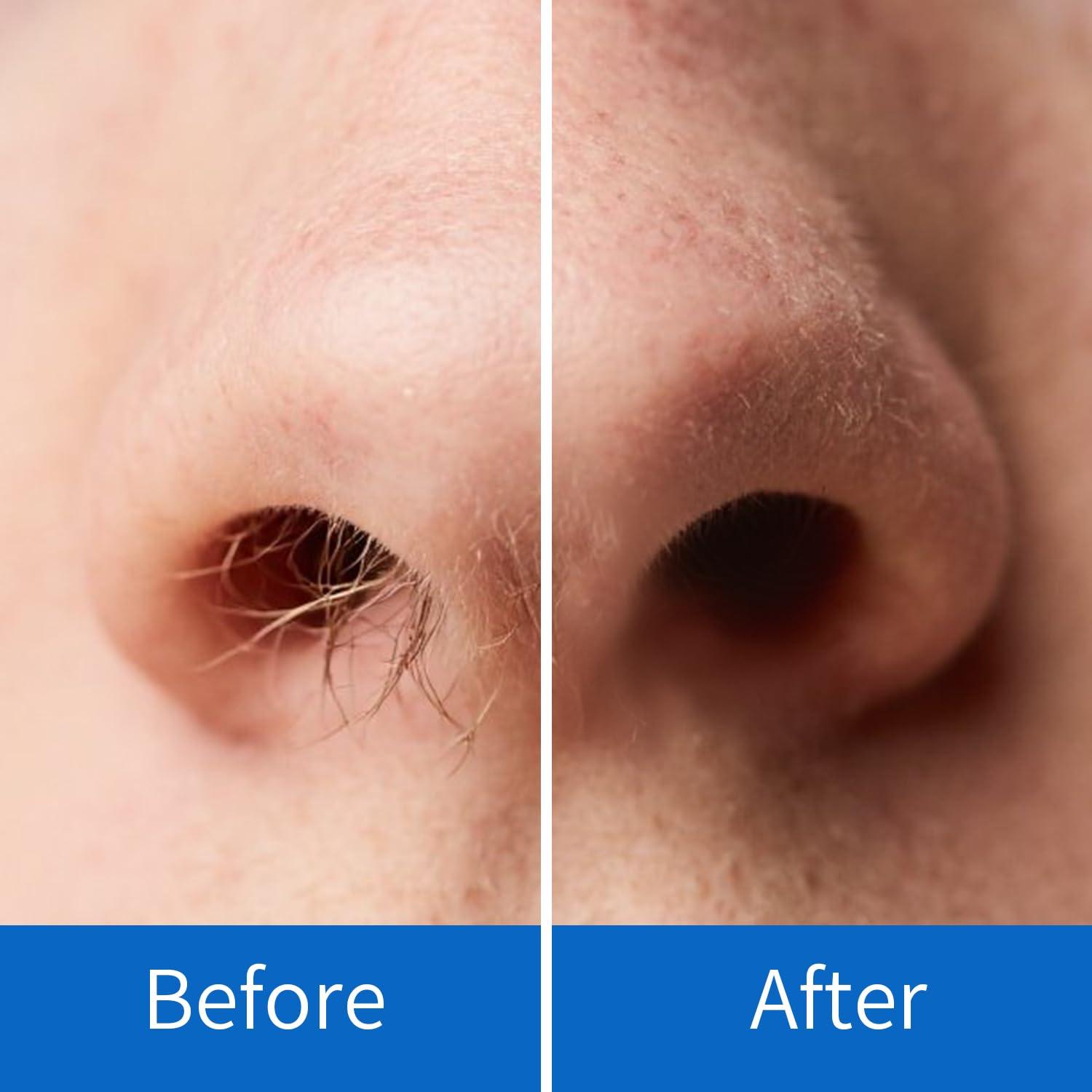 OAKEER Removedor de Vello Nasal 40 Piezas Cera Profesional