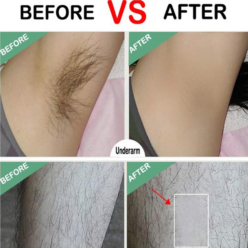 Tiras de Cera Depilatoria Dr.Pedi 20 Pcs Cuerpo y Facial