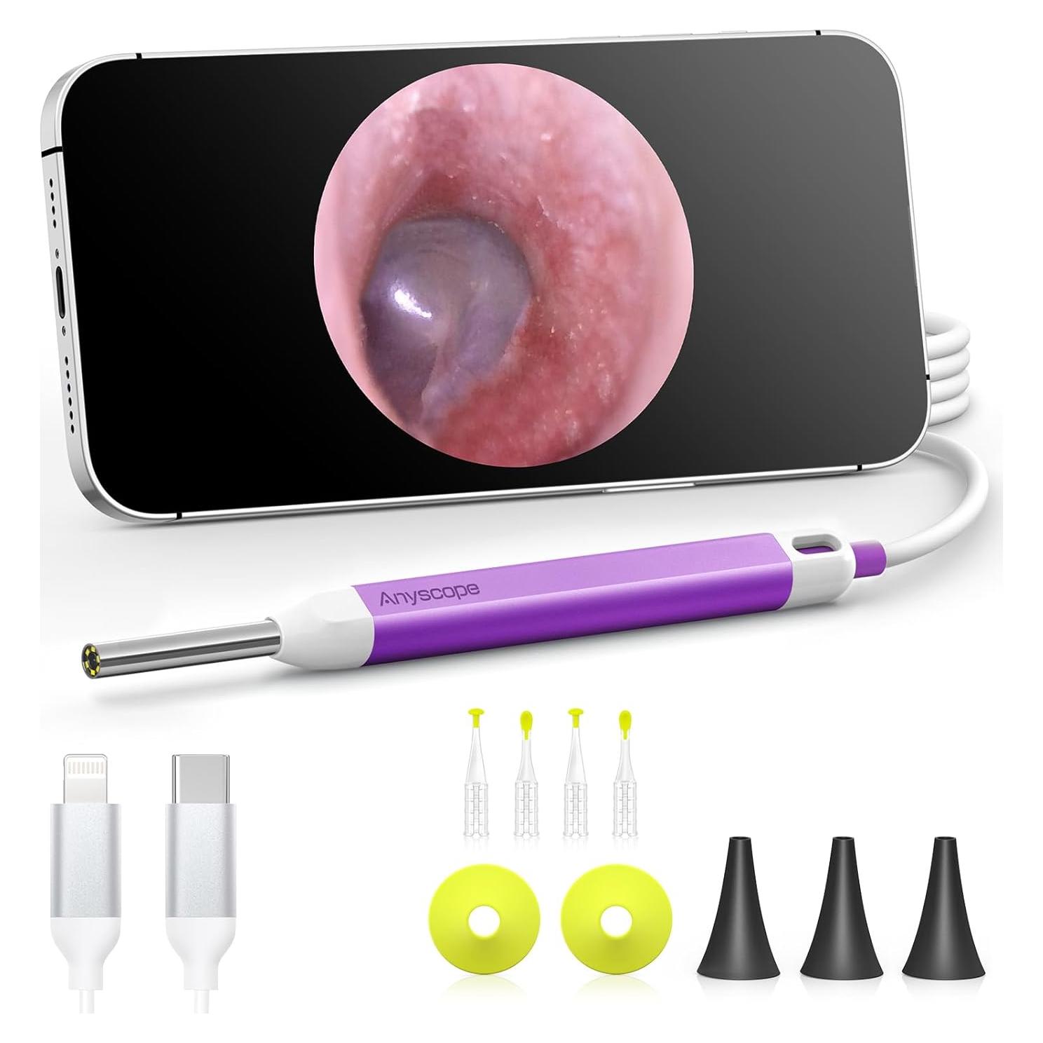 Otoscopio Digital HD AnyScope con Luz LED y Herramientas