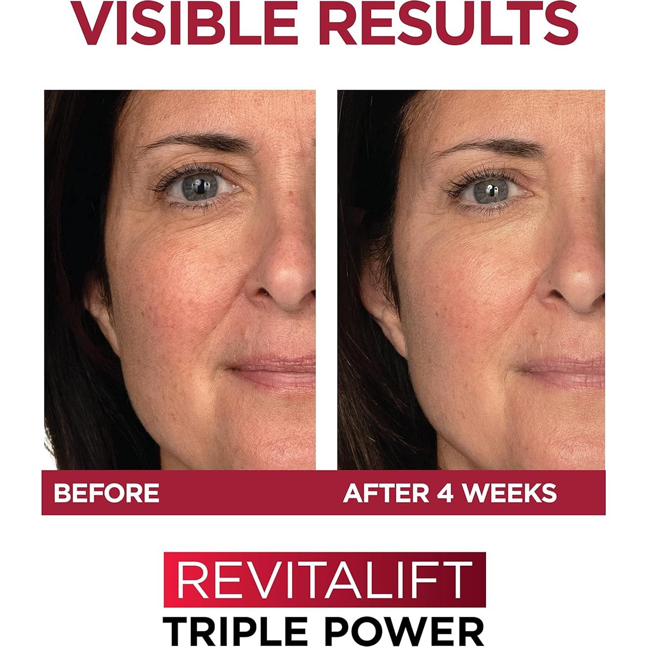 Kit Antienvejecimiento L'Oreal Revitalift Suero + Hidratante