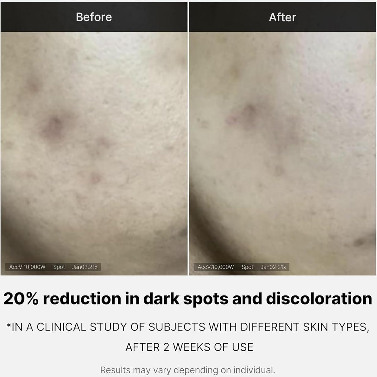 Serum Facial Medicube Deep Vita C 14.5% - 10g x 3 Botellas