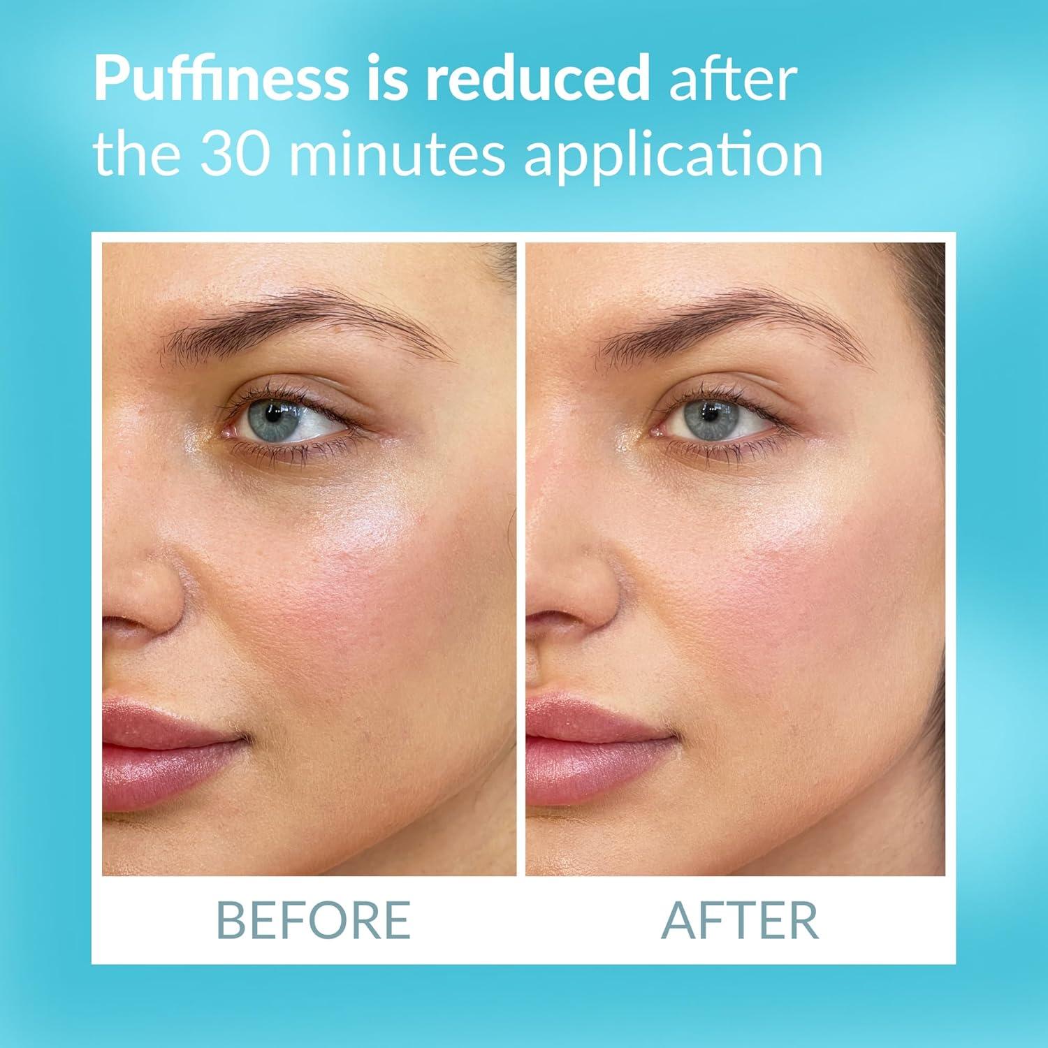 Parche Ocular Talika - Terapia Suavizante Reutilizable 1 Unidad