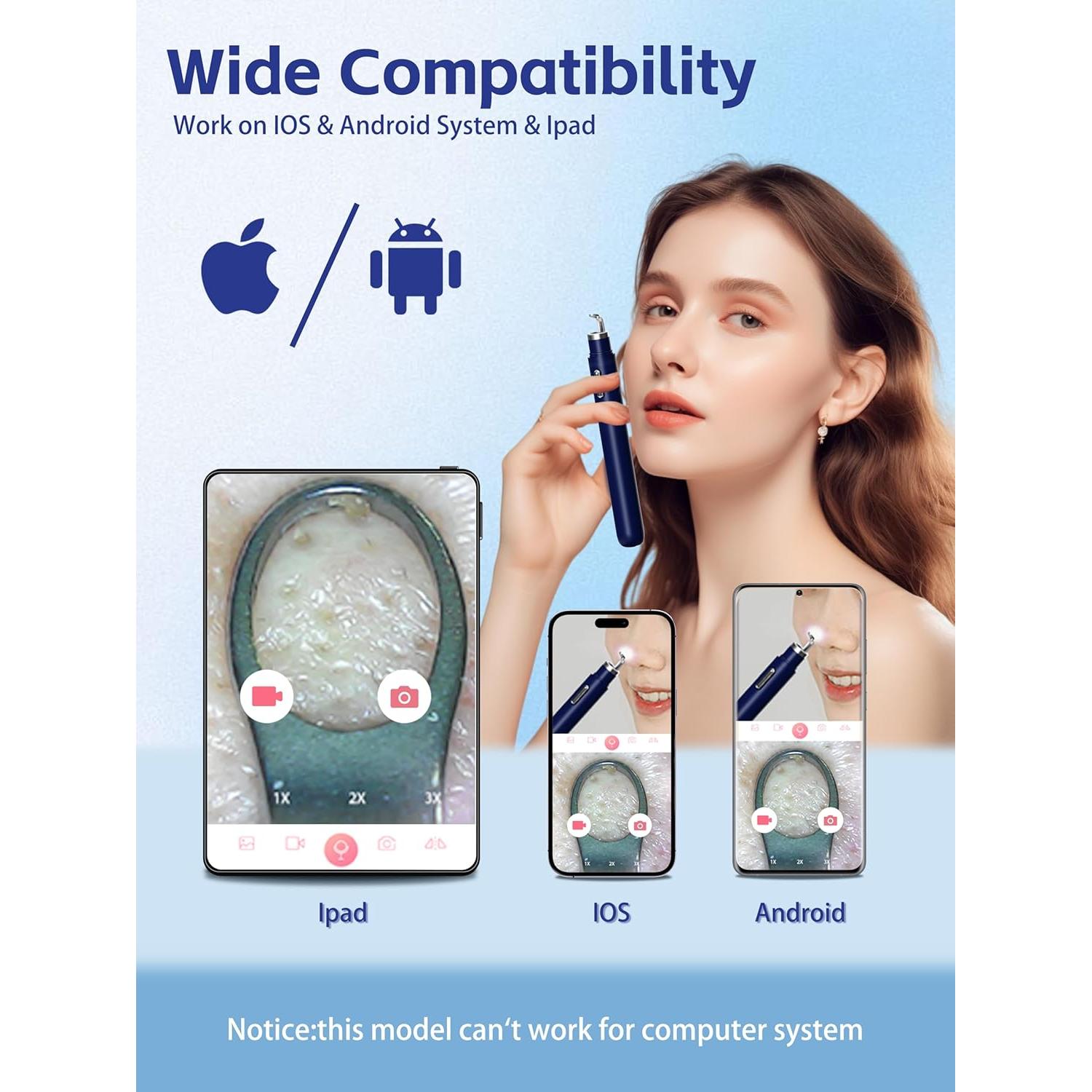 Extractor de Puntos Negros con Cámara 20X Shenmai - Limpiador de Poros