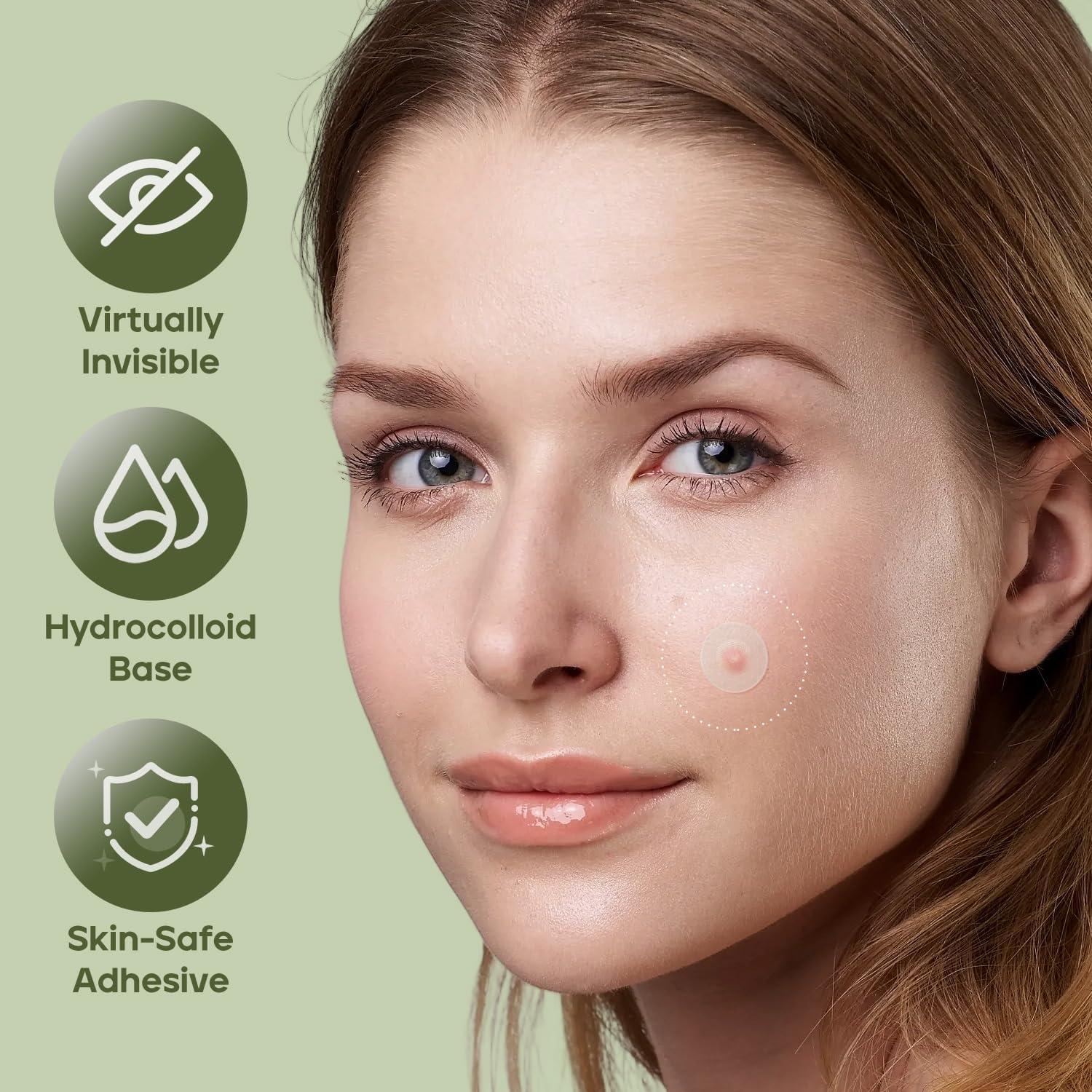 Parche para Acné Naterido Microdart 24 Piezas Ácido Hialurónico