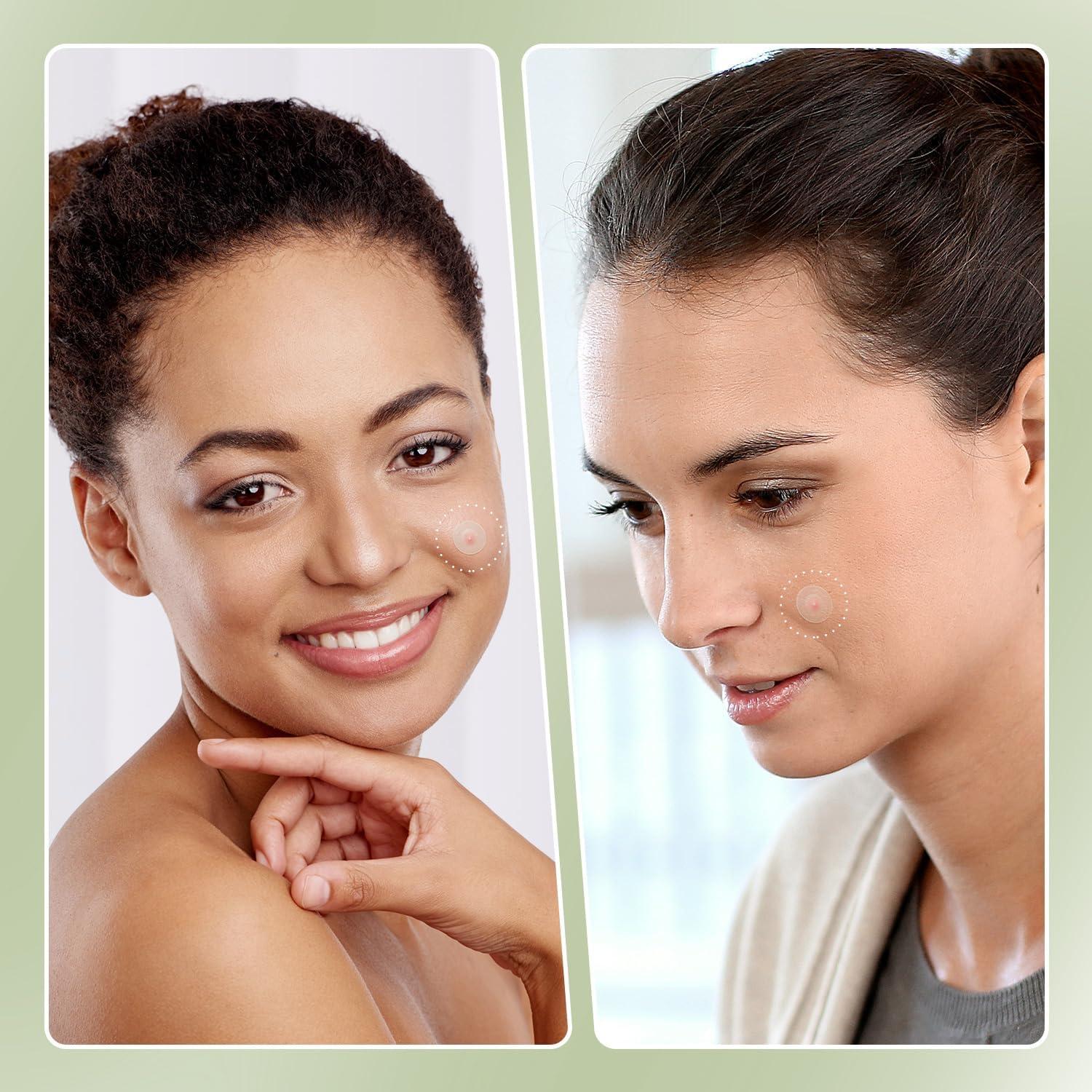 Parche para Acné Naterido Microdart 24 Piezas Ácido Hialurónico