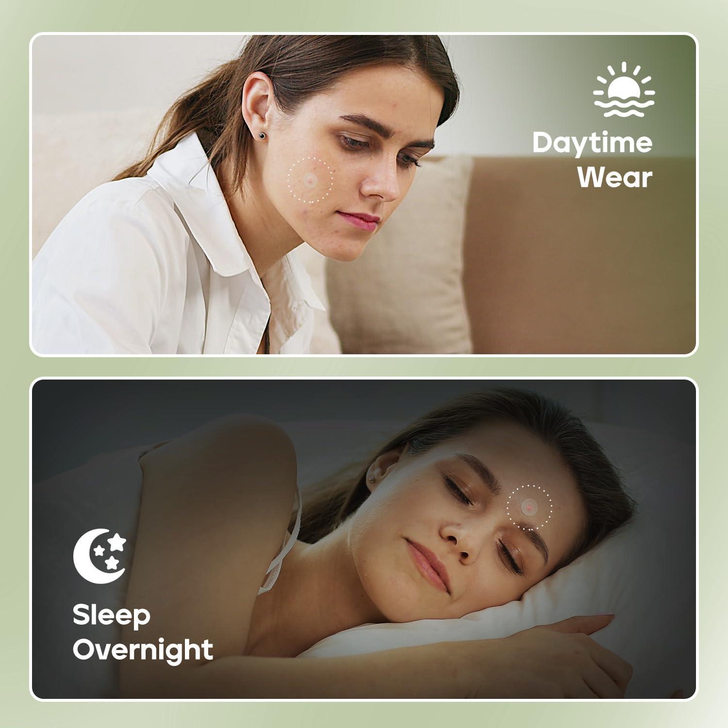 Parche para Acné Naterido Microdart 24 Piezas Ácido Hialurónico