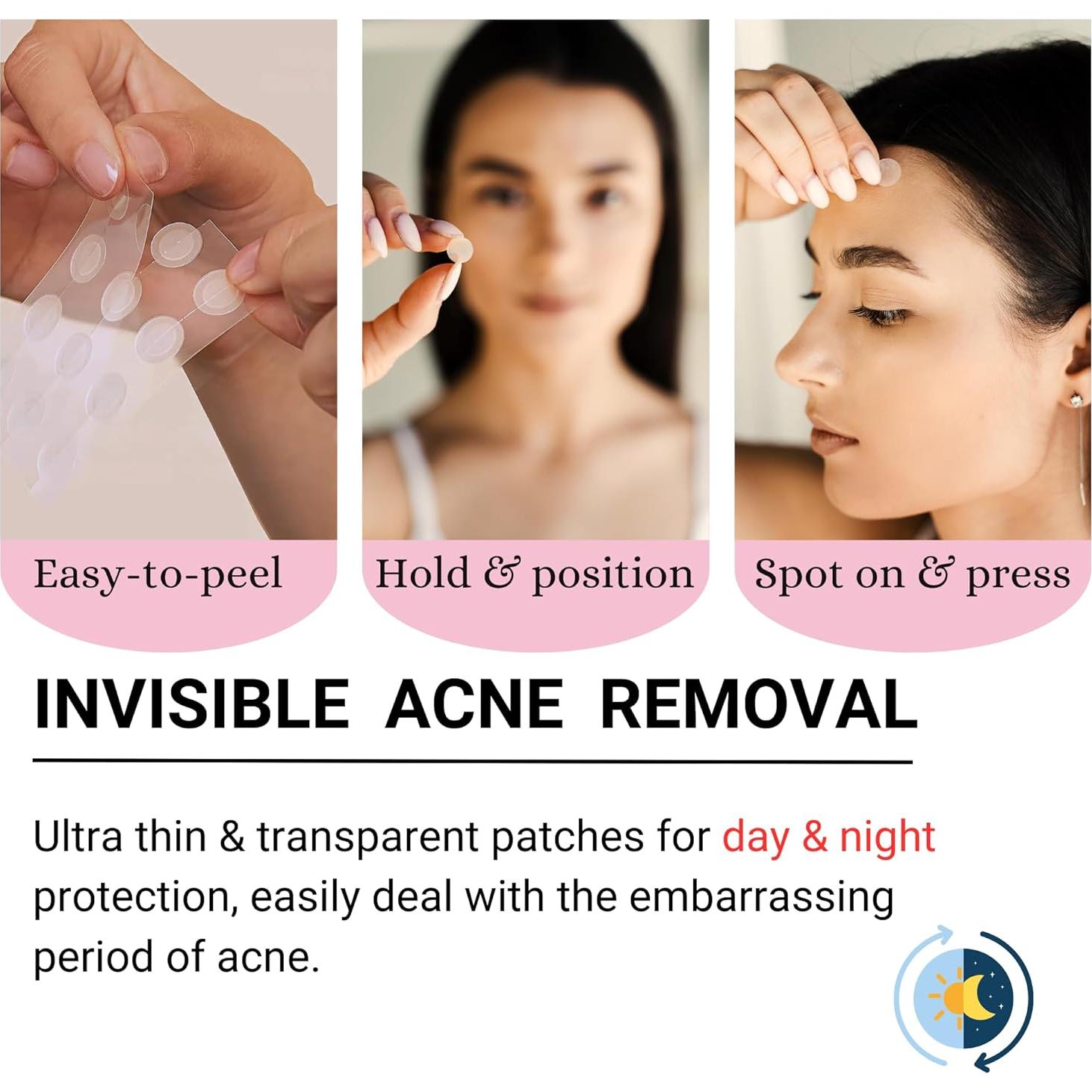 Parche Hidrocoloide SpotlessX para Acné - 96 Parches, 3 Tamaños