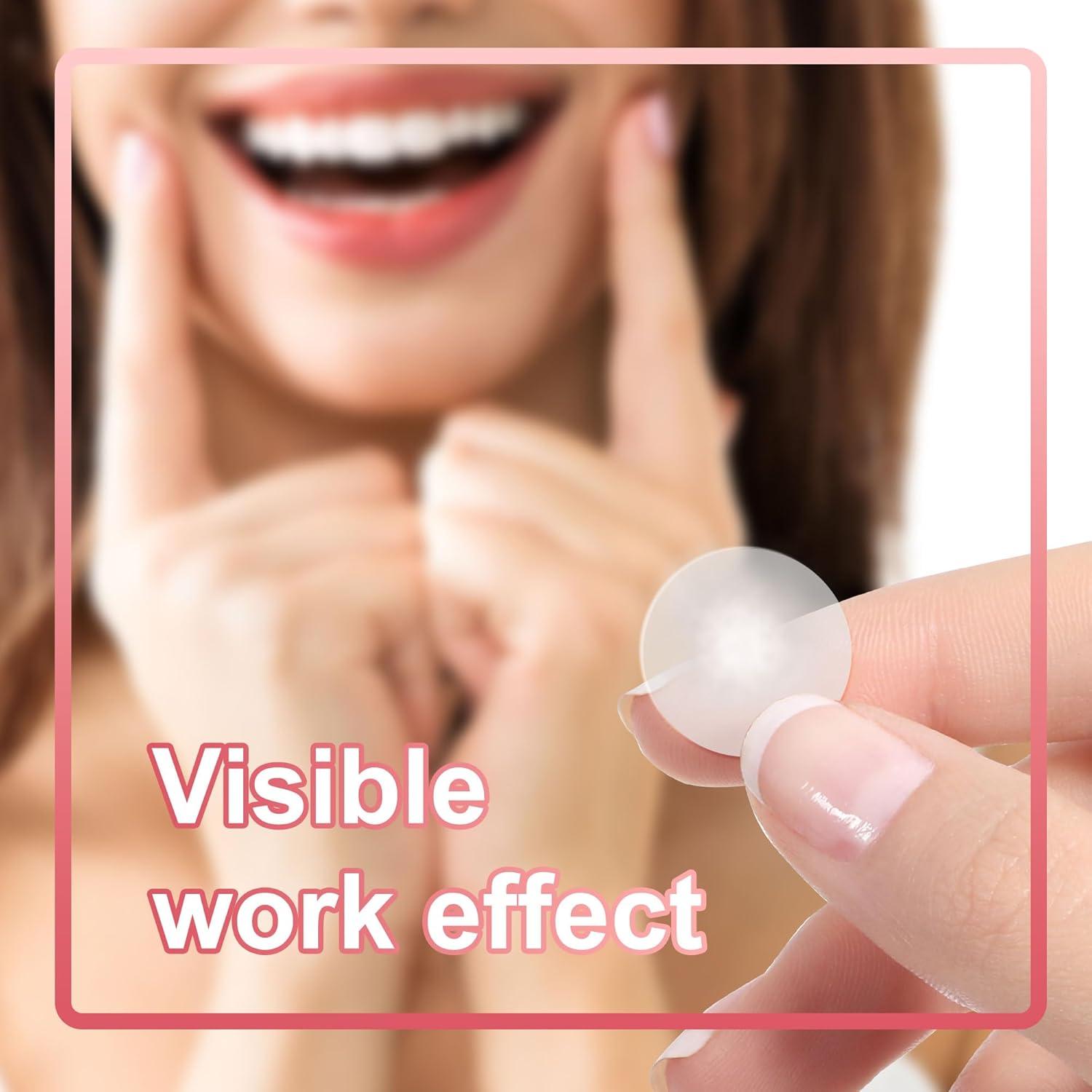 Parche para Granos CELECARE - 330 Piezas, 4 Tamaños, Hidrocoloide