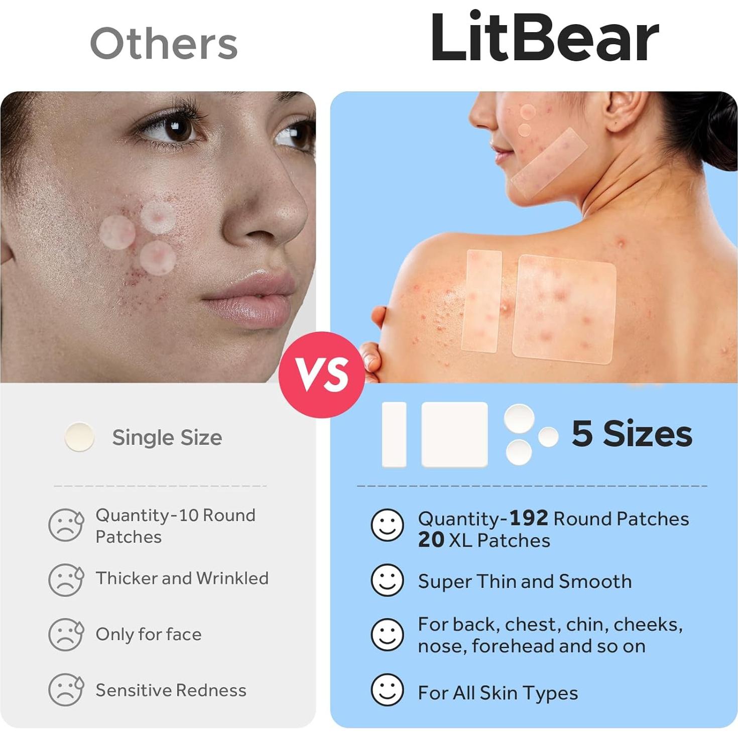 Parches para Granos LitBear - 212 Cuentas, 5 Tamaños, Hidrocoloide