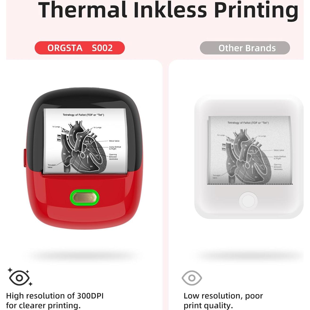 Impresora de Etiquetas ORGSTA S002 Bluetooth Térmica Portátil