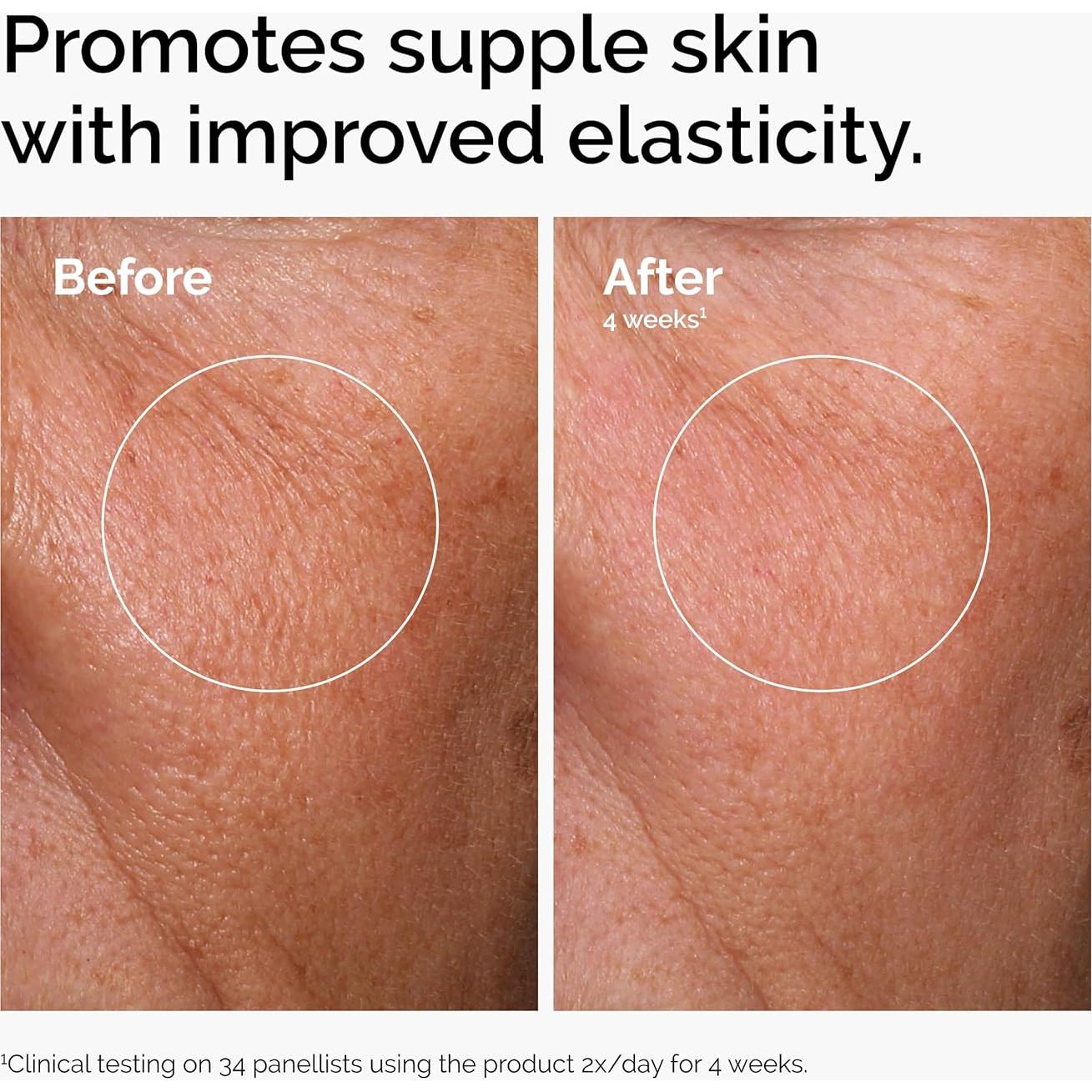 Dúo Exfoliante The Ordinary AHA 30% + BHA 2% 30ml Vegano