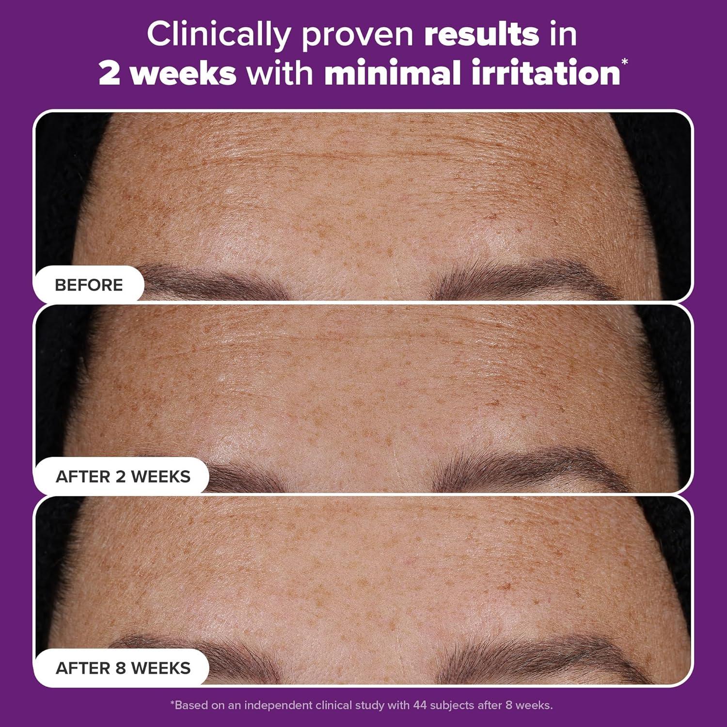 Suero Anti-Envejecimiento Paula's Choice 5ml Doble Retinoide