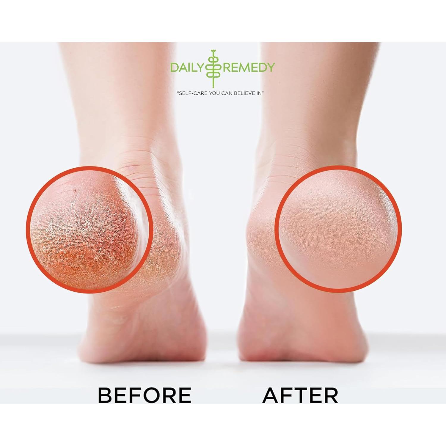 Remojo para Pies Aliviador de Músculos Daily Remedy 0.45 kg