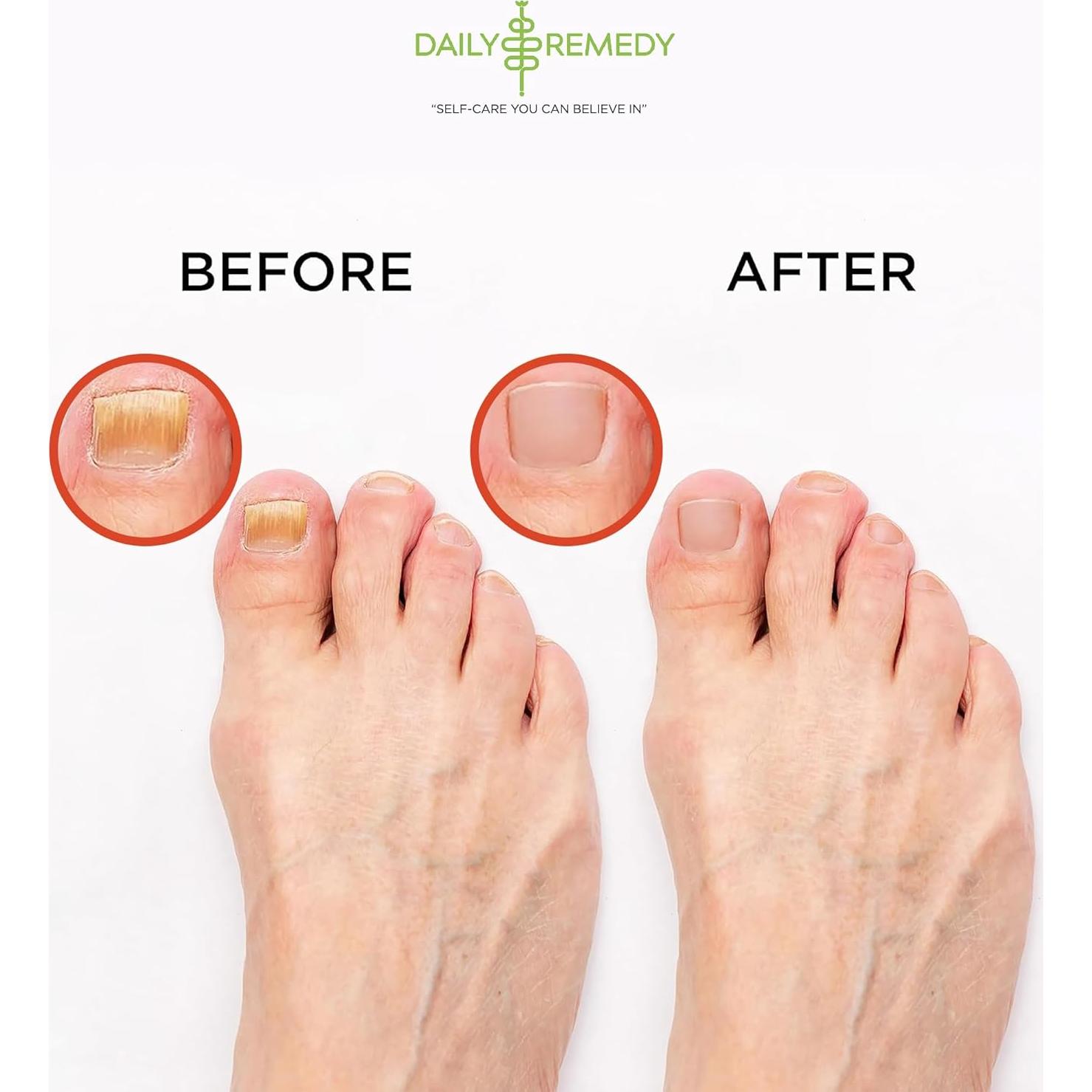 Remojo para Pies Aliviador de Músculos Daily Remedy 0.45 kg