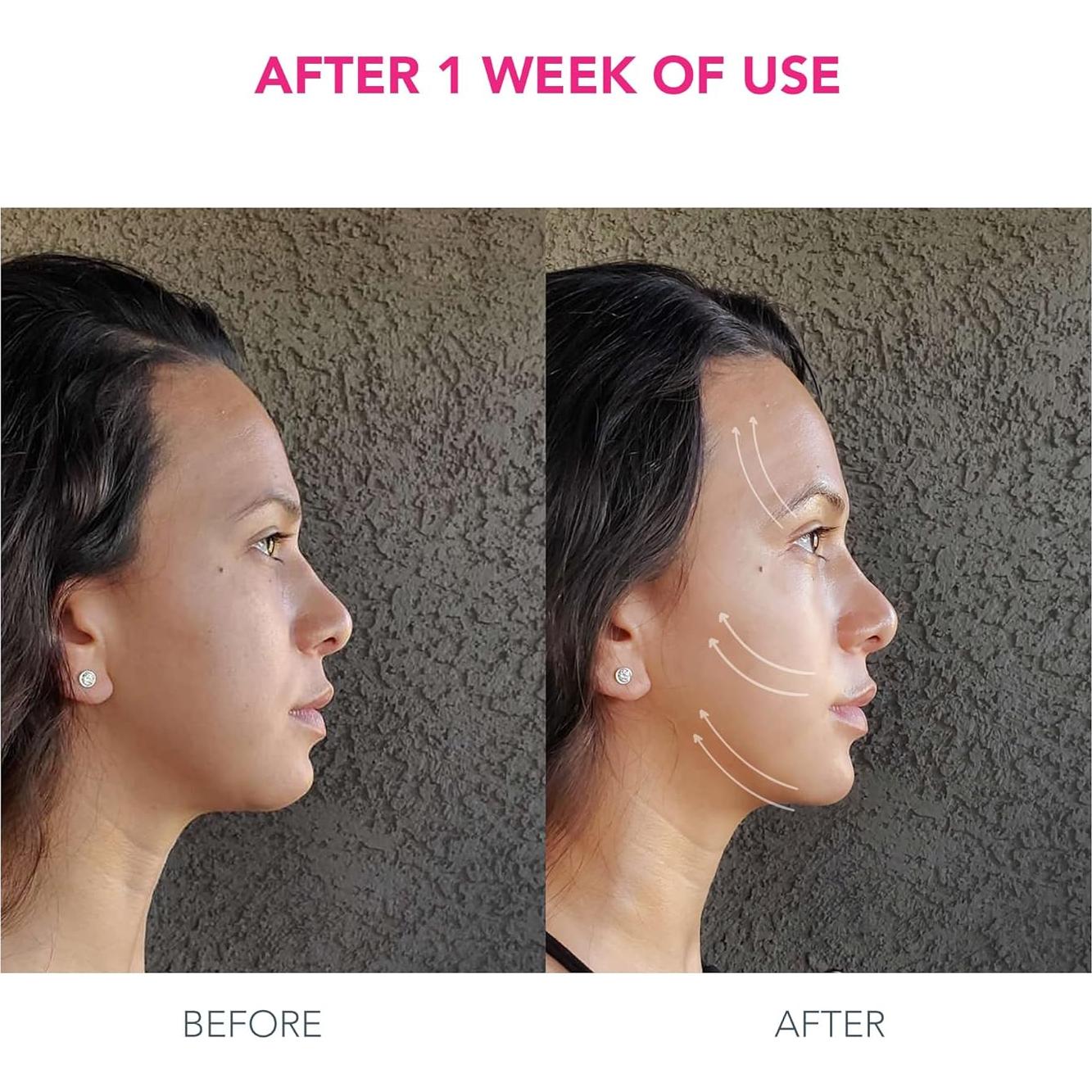 Dispositivo Facial Antienvejecimiento FOREO Bear + 2 Sueros 30 mL