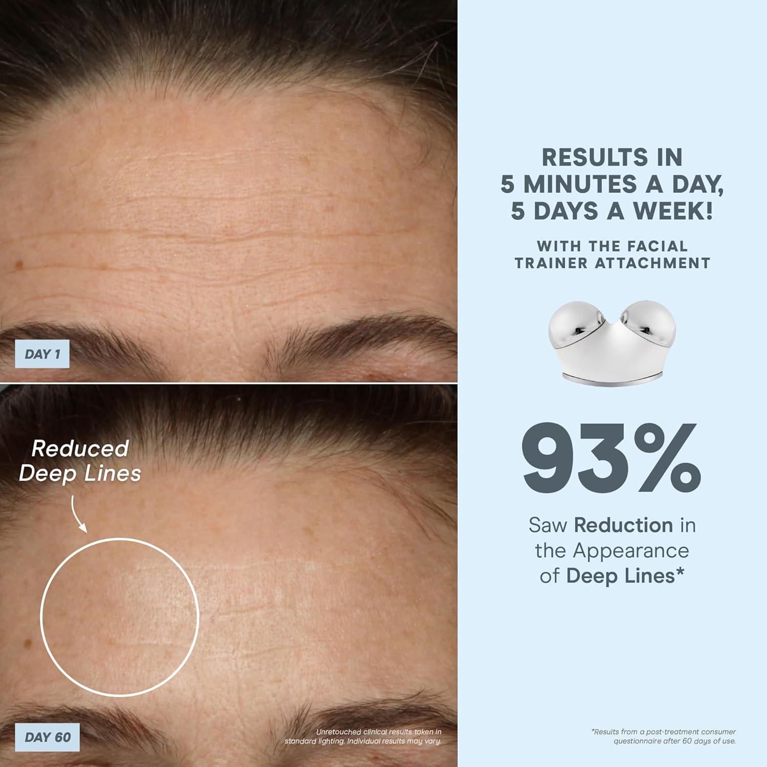 Dispositivo Facial Microcorriente NuFACE TRINITY+ con Luz Roja