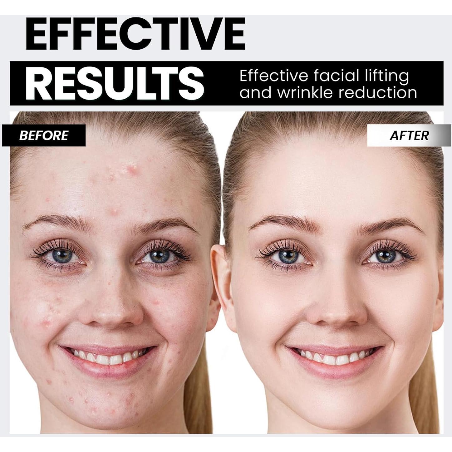 Dispositivo Facial de Microcorriente Hunvva EP-300 Luz Roja