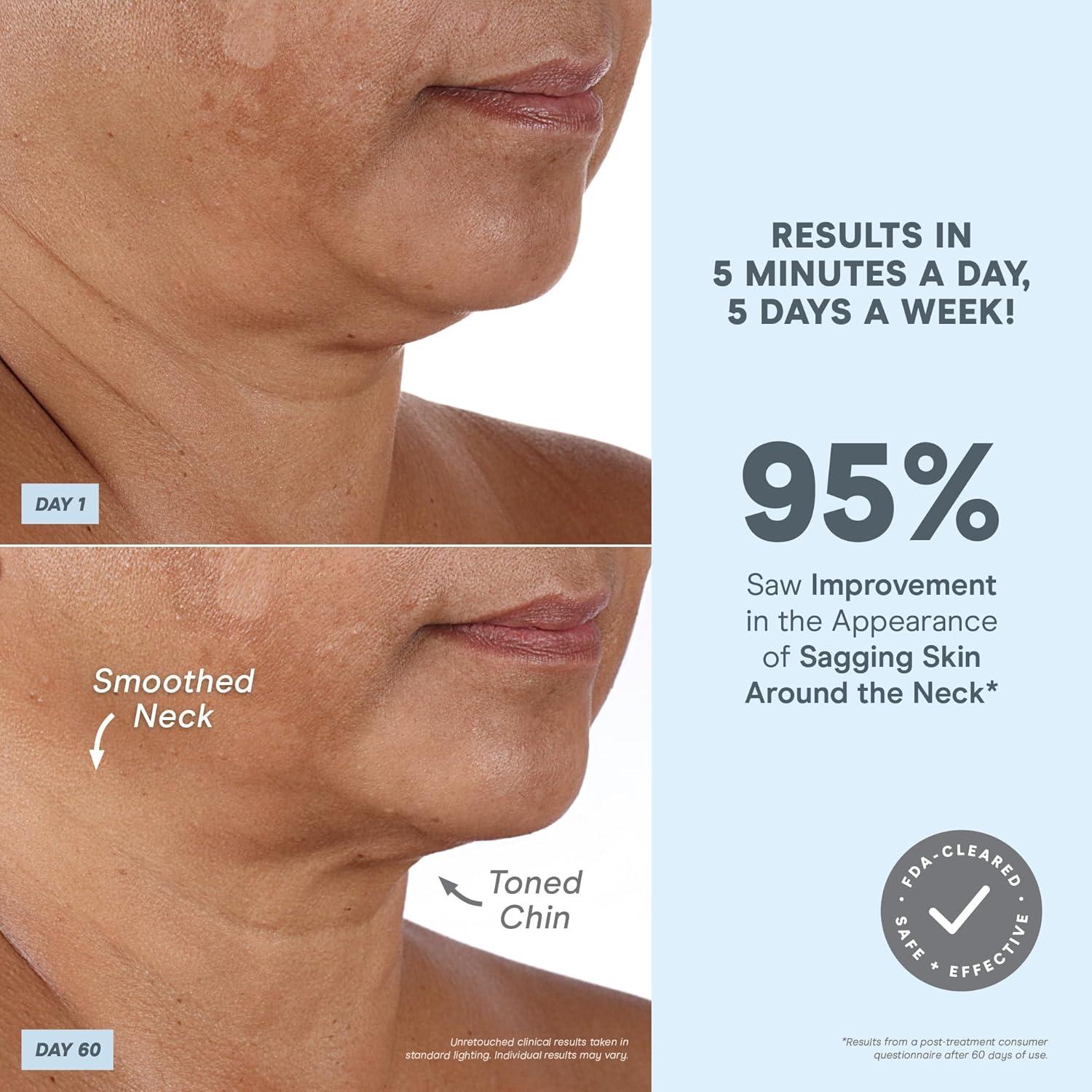 Dispositivo Facial Microcorriente NuFACE MINI+ - Tonifica y Levanta