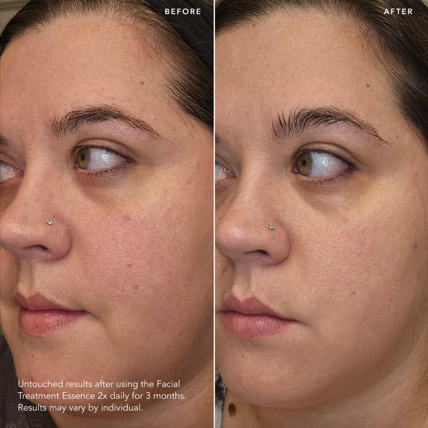 SK-II Esencia Facial Antienvejecimiento 74.9 ml + 6 Mascarillas Iluminadoras