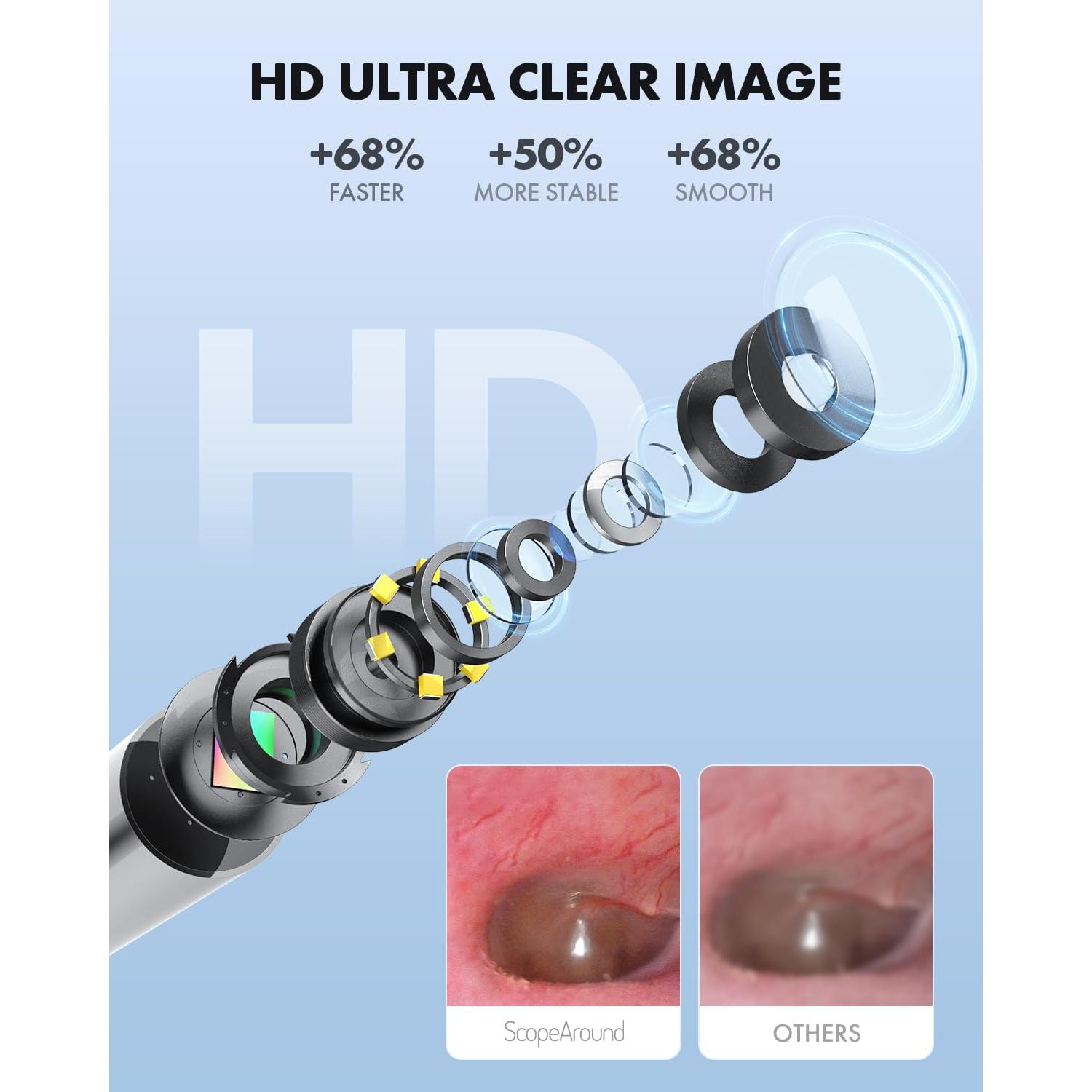 Otoscopio WiFi 720p HD ScopeAround con Luz LED 3.9mm