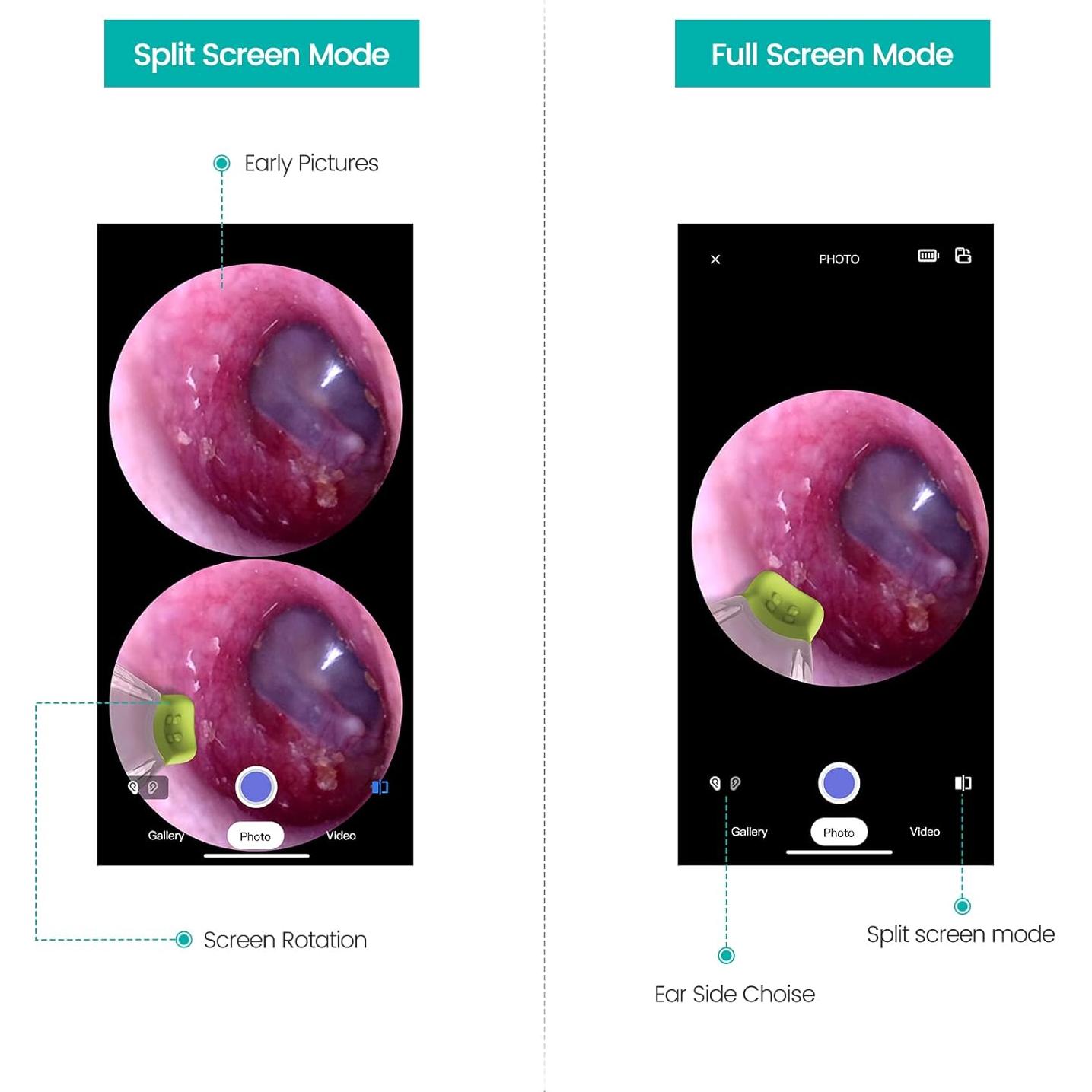 Otoscopio WiFi 720p HD ScopeAround con Luz LED 3.9mm